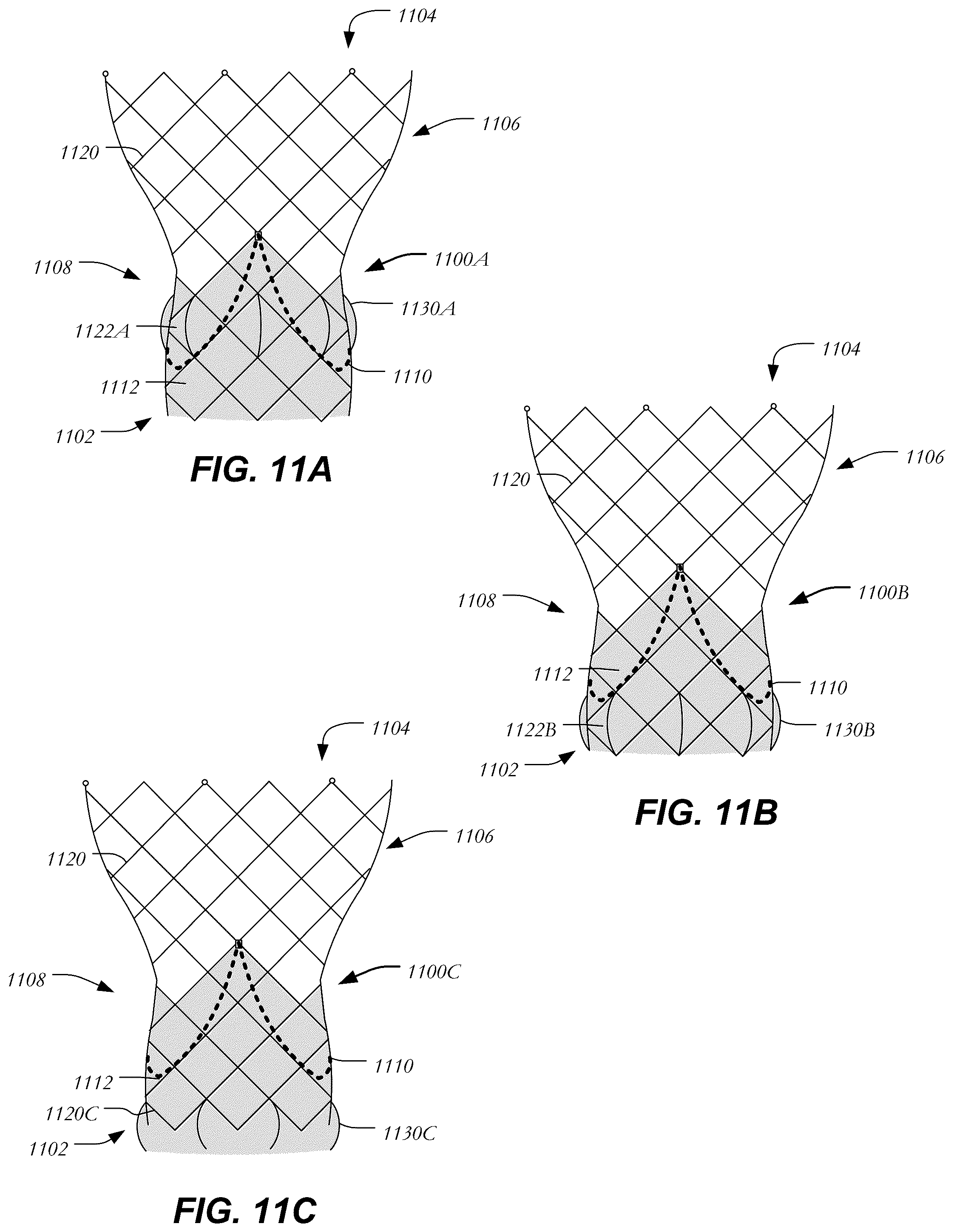 Patent US12403005 Figure 9 – Bowed runners and corresponding valve assemblies for paravalvular leak protection