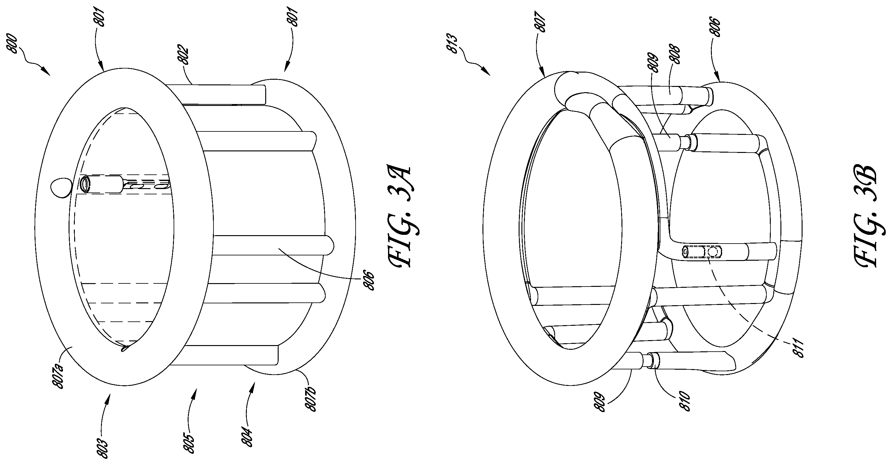 Patent US12403007 Figure 4 – Prosthetic implant delivery device with introducer catheter