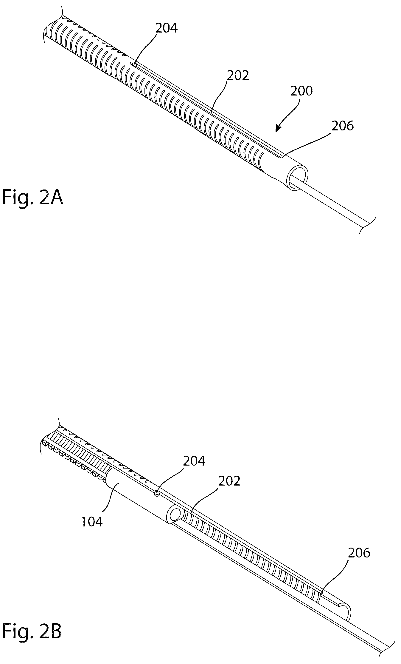 Patent US12403008 Figure 3 – Adjustable medical device