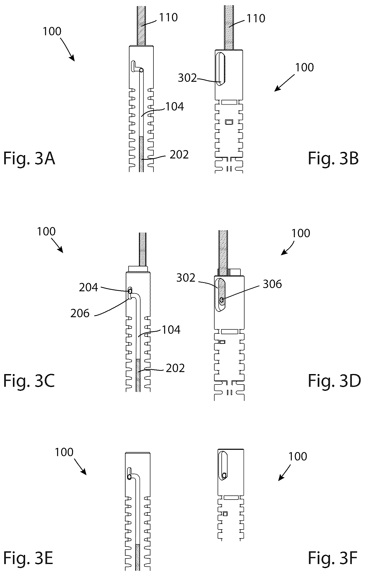 Patent US12403008 Figure 4 – Adjustable medical device