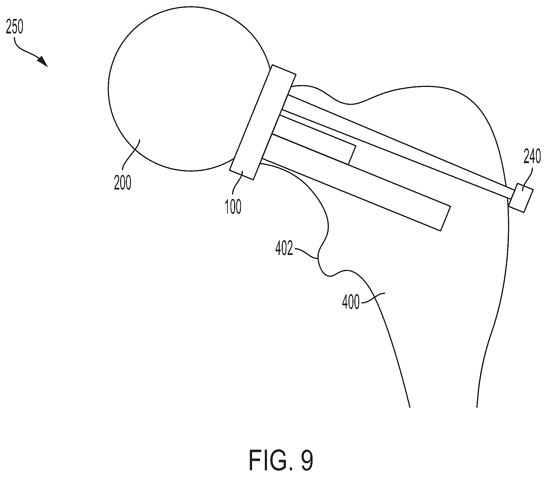 Patent US12403009 Figure 9 – Femoral head arthroplasty system