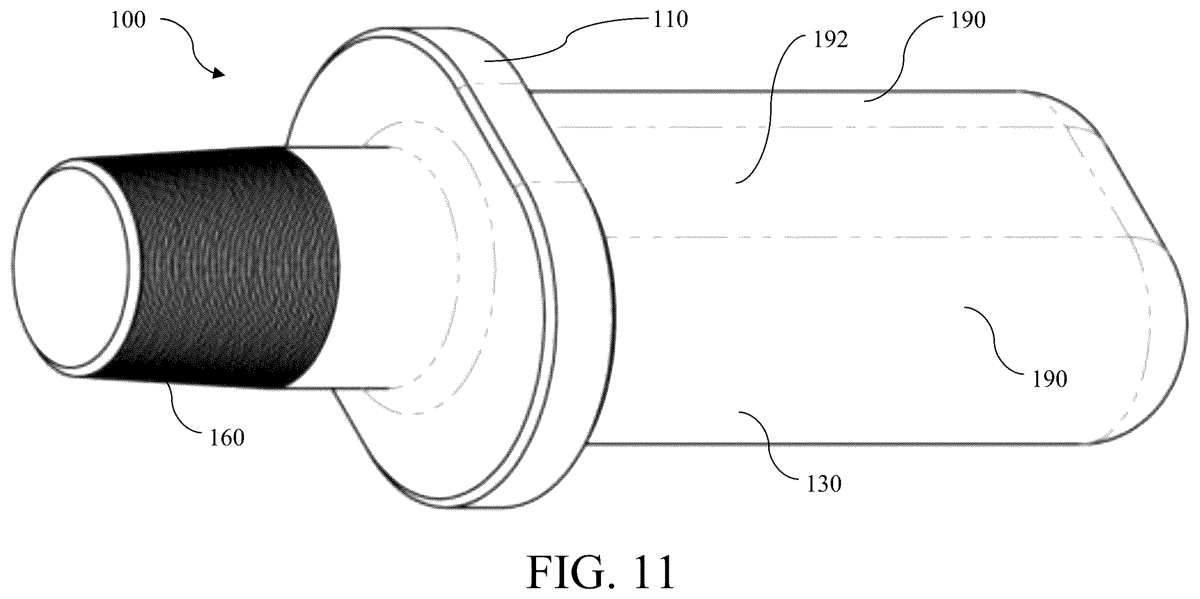 Patent US12403009 Figure 11 – Femoral head arthroplasty system