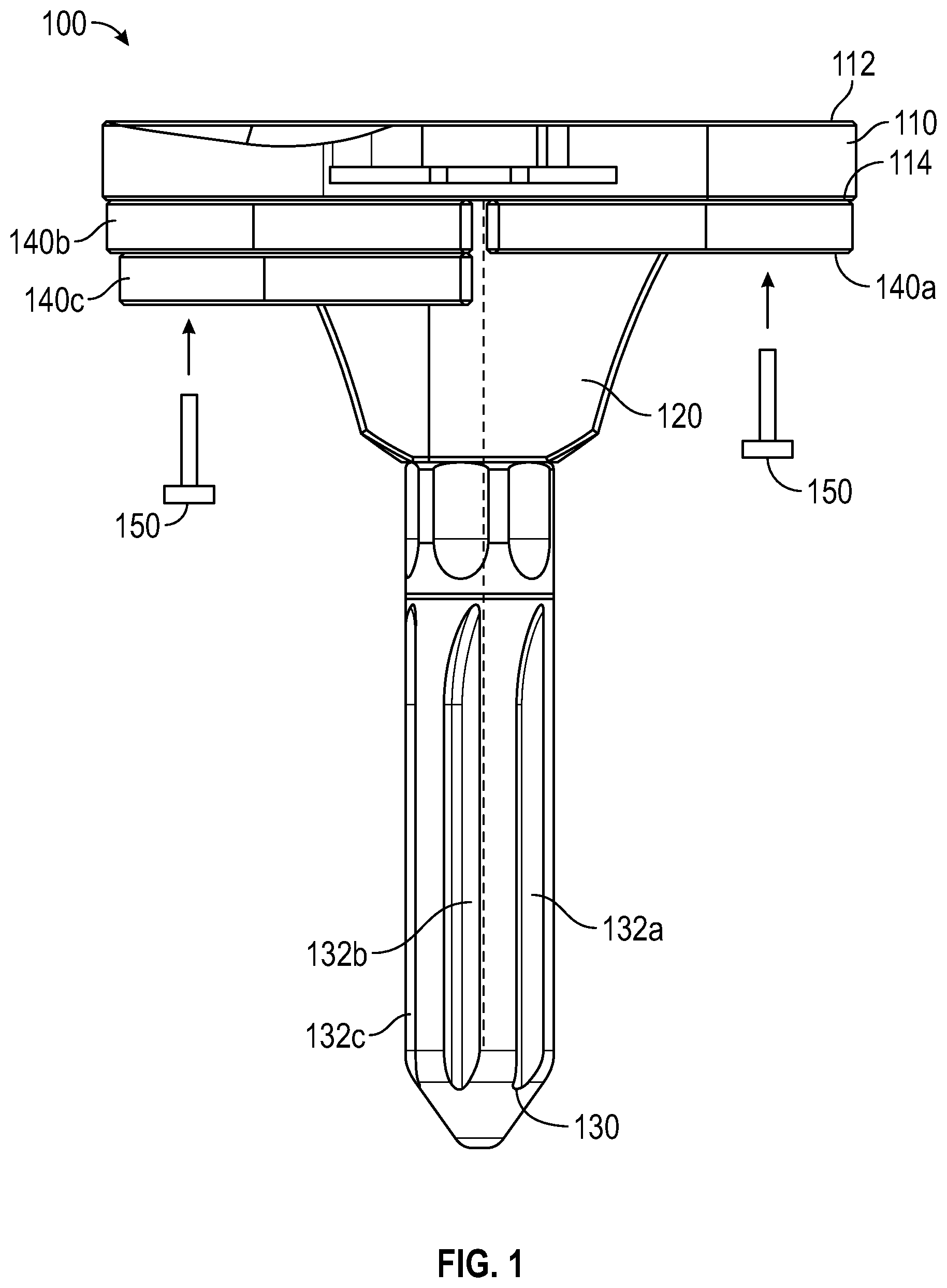 Patent US12403010 Figure 1 – Knee replacement implant having stackable spacers