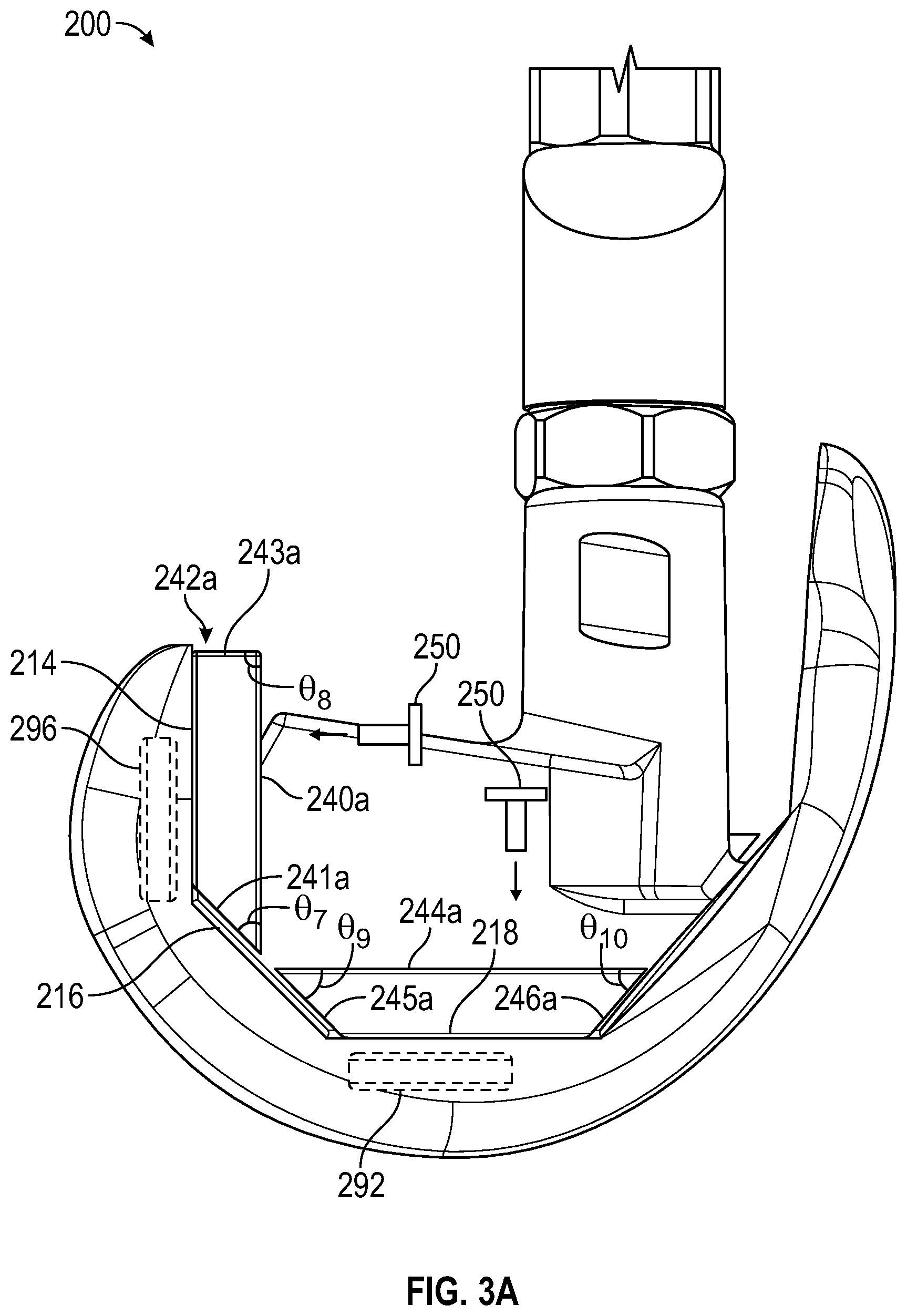 Patent US12403010 Figure 3 – Knee replacement implant having stackable spacers