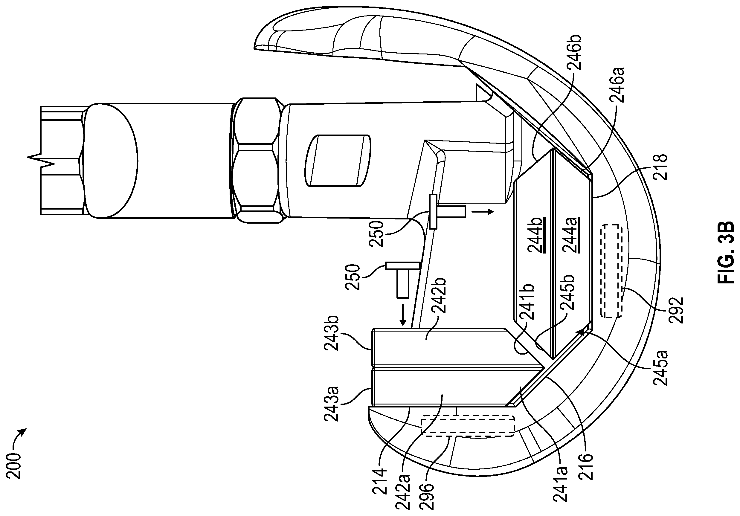 Patent US12403010 Figure 4 – Knee replacement implant having stackable spacers