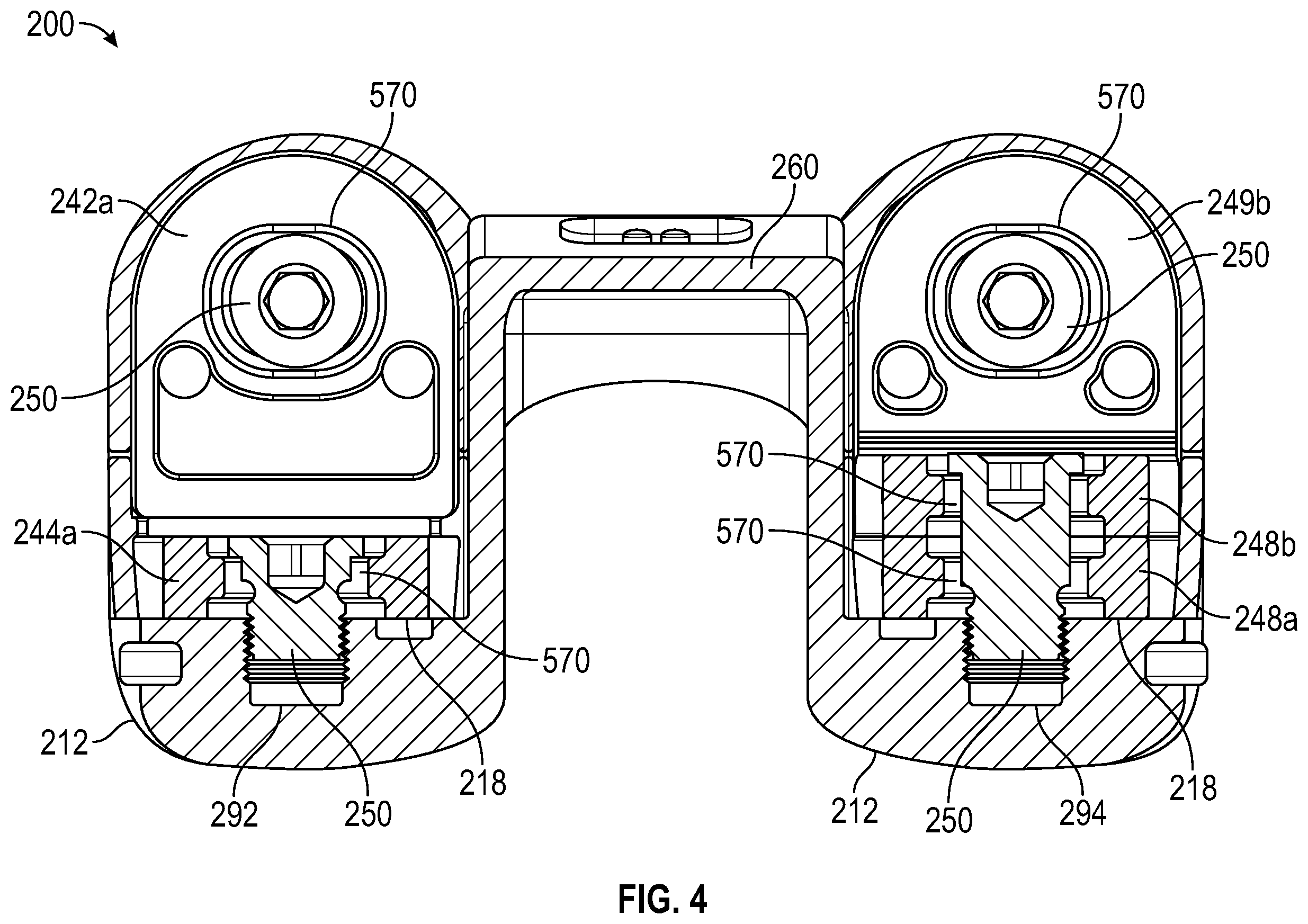 Patent US12403010 Figure 7 – Knee replacement implant having stackable spacers