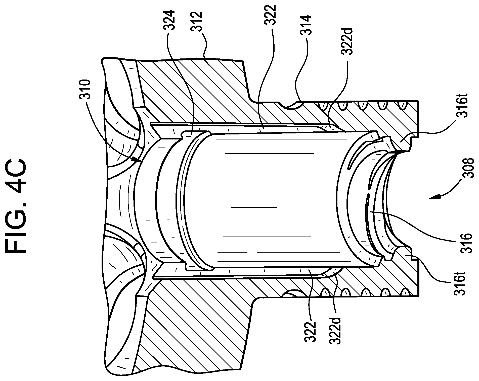 Patent US12403011 Figure 5 – Baseplate of a modular shoulder joint prosthesis and related methods for implanting the same