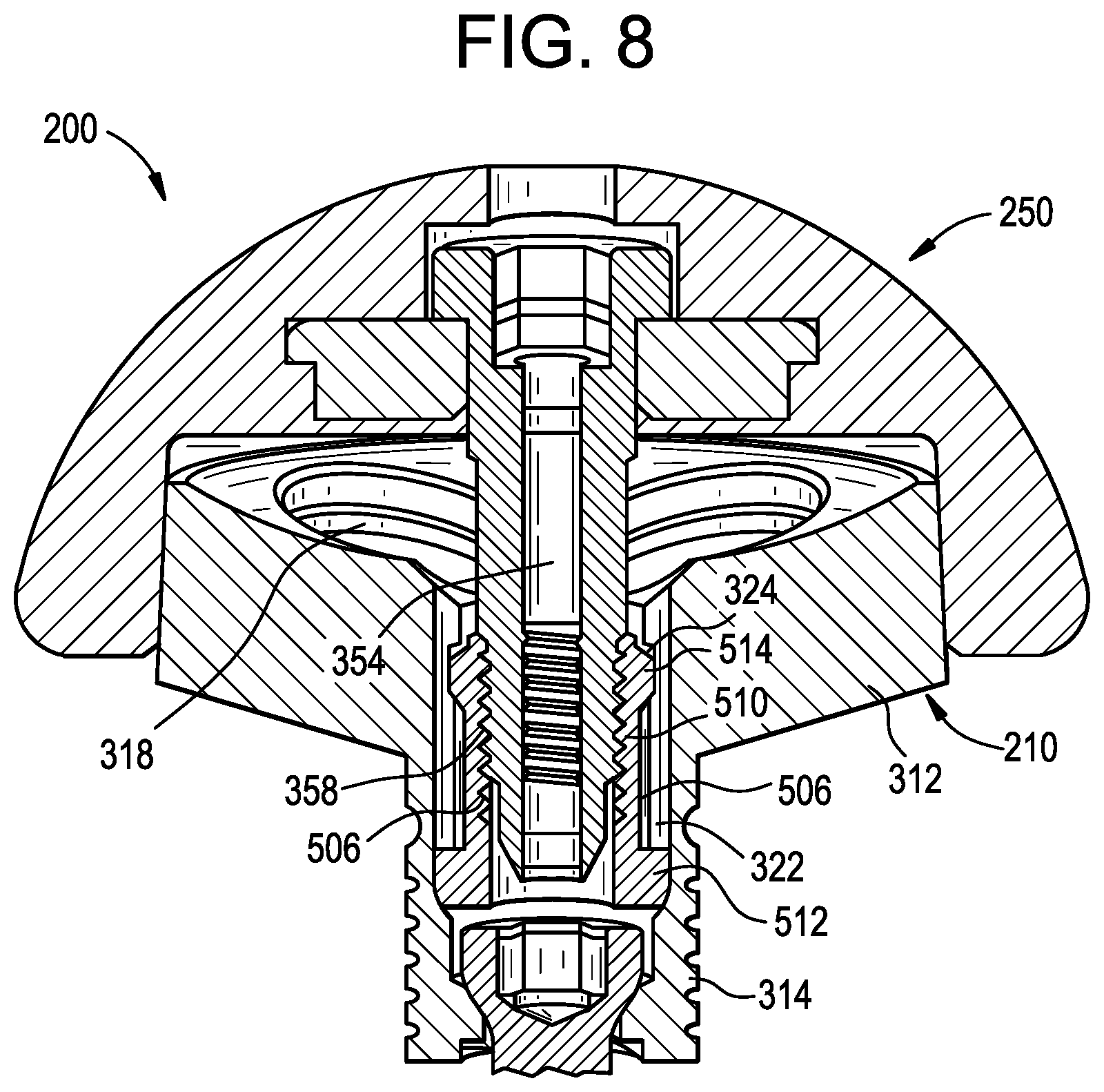 Patent US12403011 Figure 9 – Baseplate of a modular shoulder joint prosthesis and related methods for implanting the same