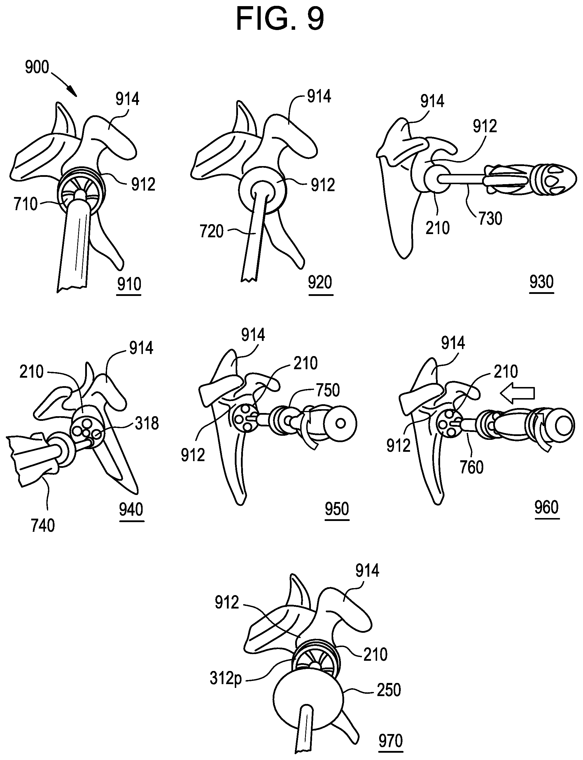 Patent US12403011 Figure 10 – Baseplate of a modular shoulder joint prosthesis and related methods for implanting the same