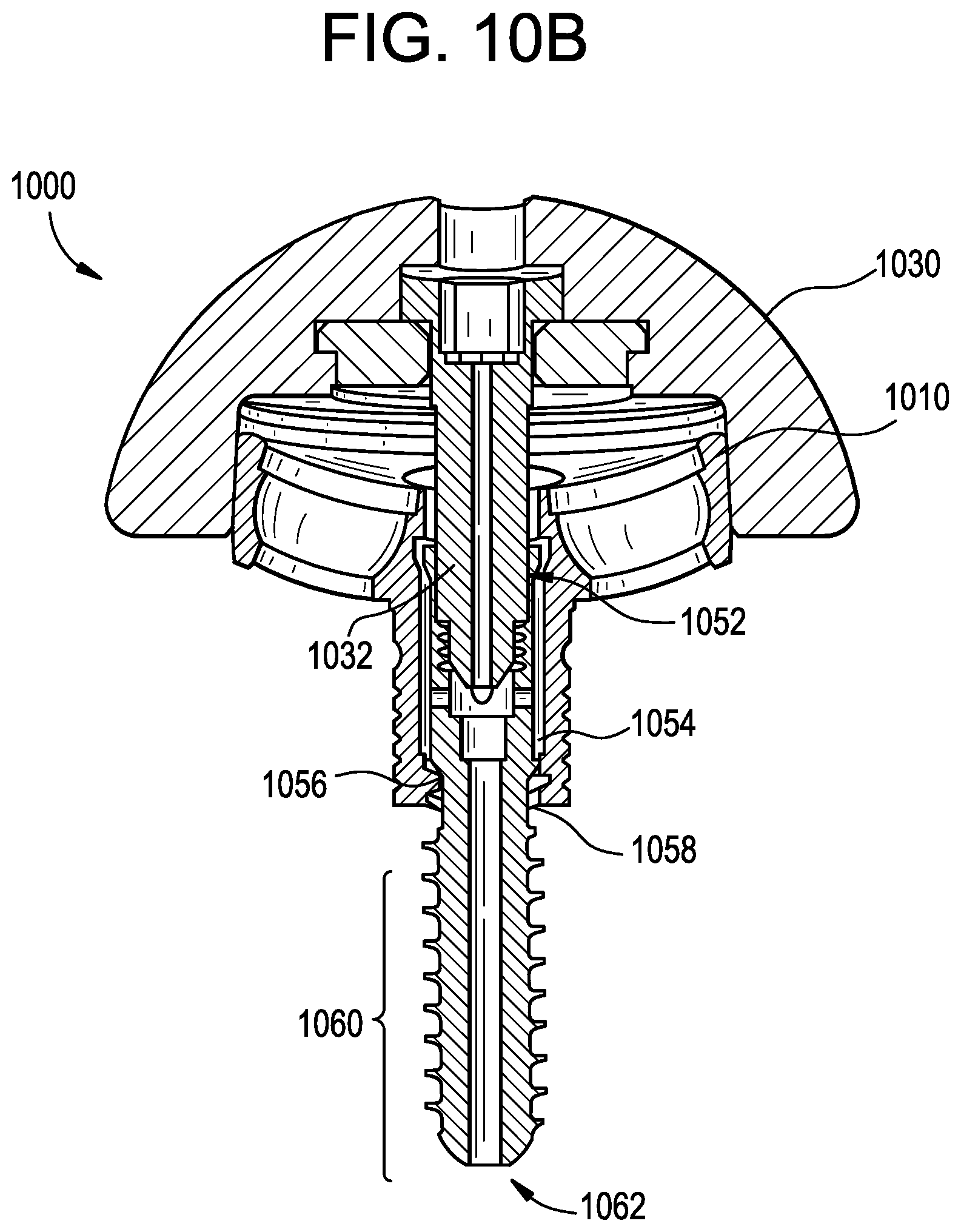 Patent US12403011 Figure 12 – Baseplate of a modular shoulder joint prosthesis and related methods for implanting the same