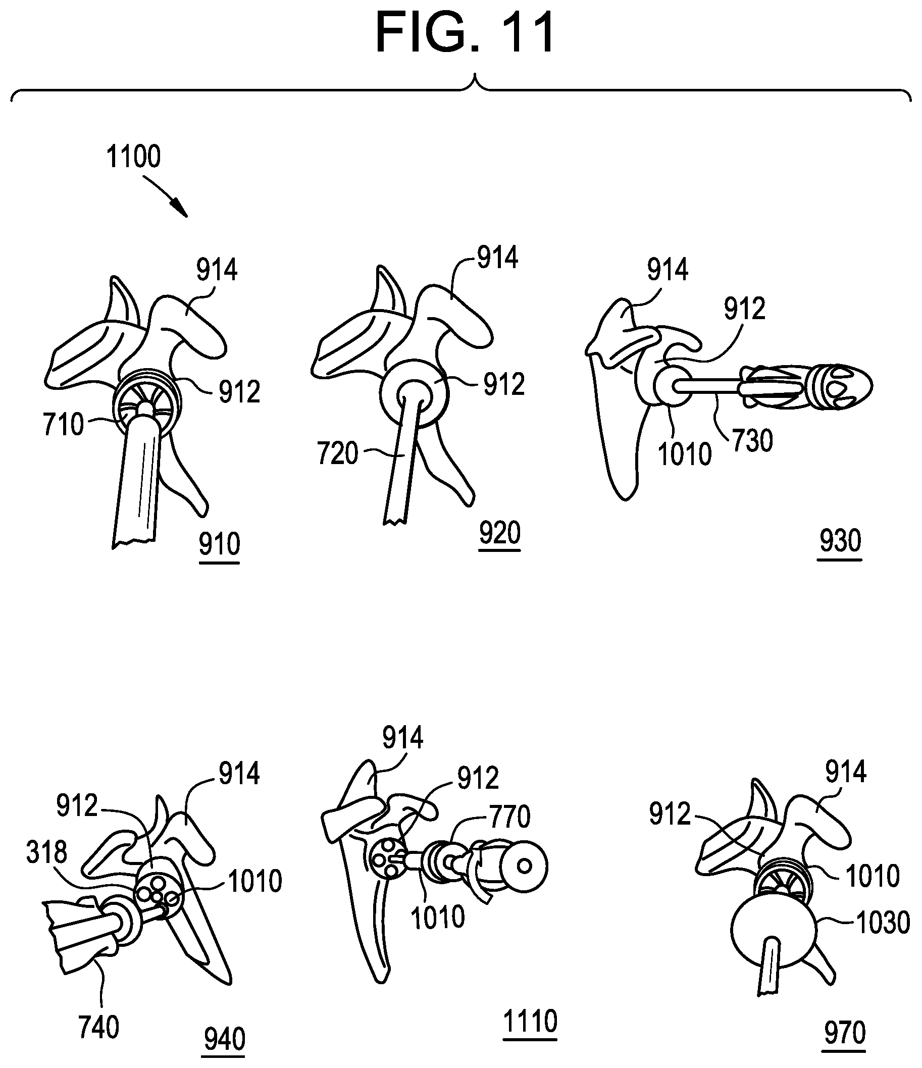 Patent US12403011 Figure 14 – Baseplate of a modular shoulder joint prosthesis and related methods for implanting the same