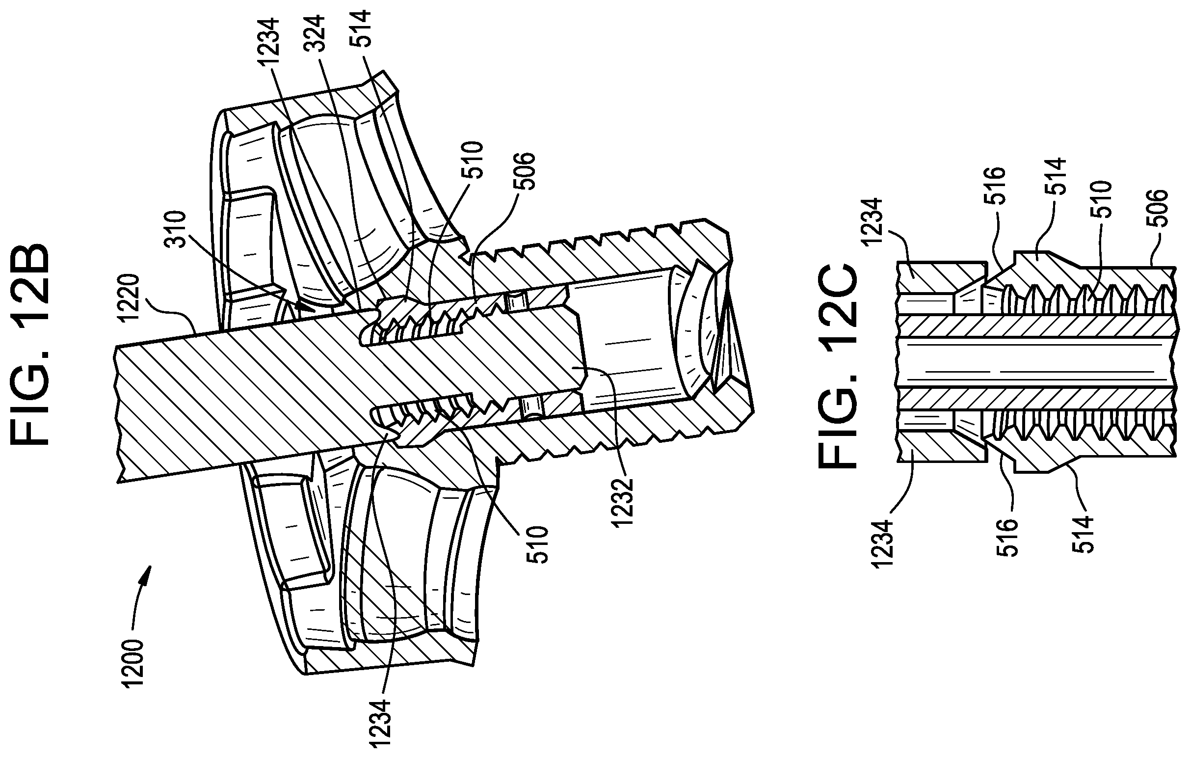 Patent US12403011 Figure 16 – Baseplate of a modular shoulder joint prosthesis and related methods for implanting the same
