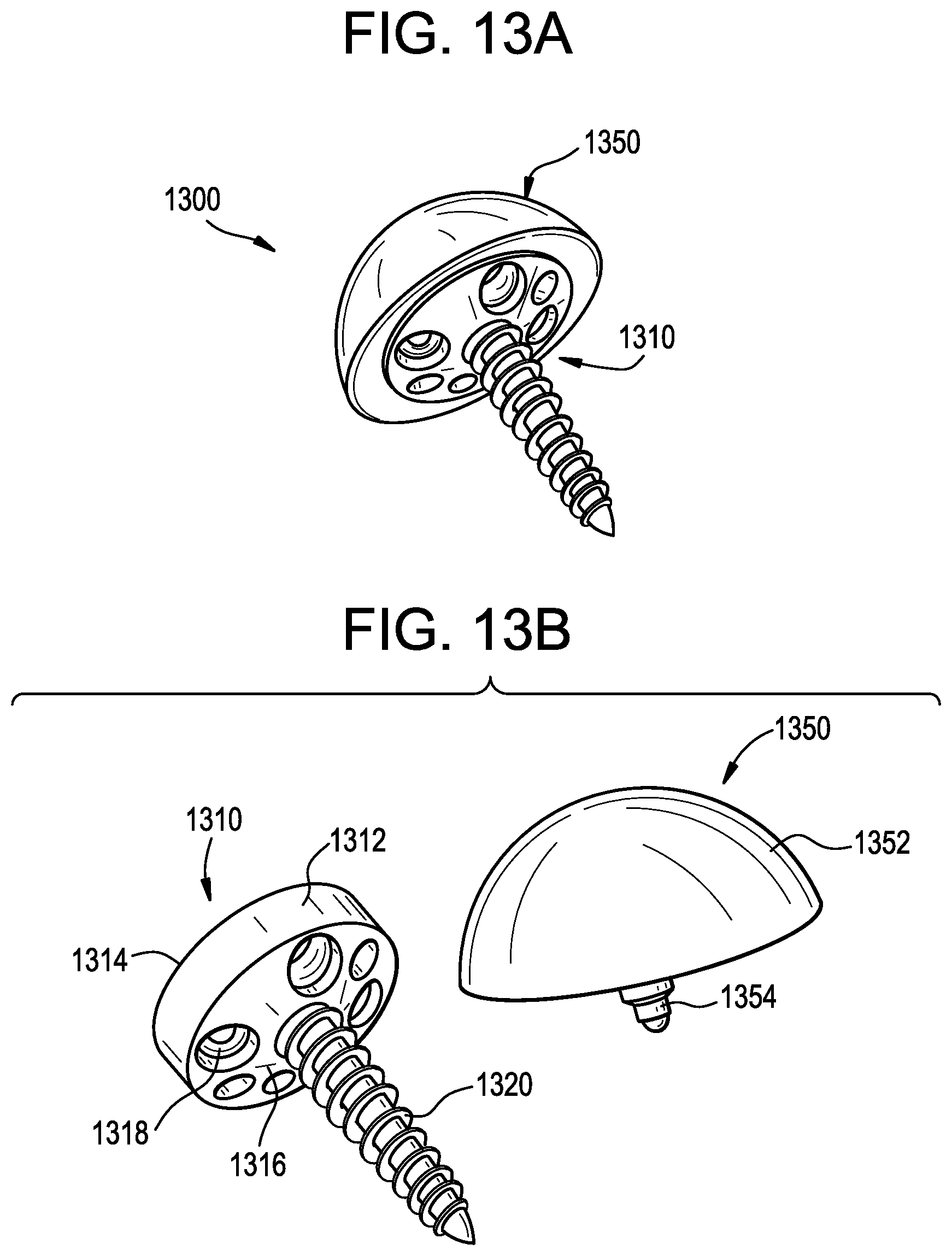 Patent US12403011 Figure 17 – Baseplate of a modular shoulder joint prosthesis and related methods for implanting the same