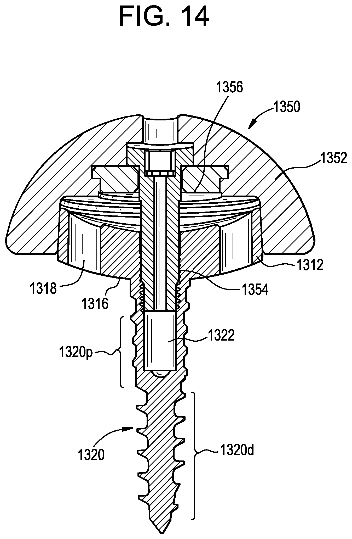 Patent US12403011 Figure 18 – Baseplate of a modular shoulder joint prosthesis and related methods for implanting the same