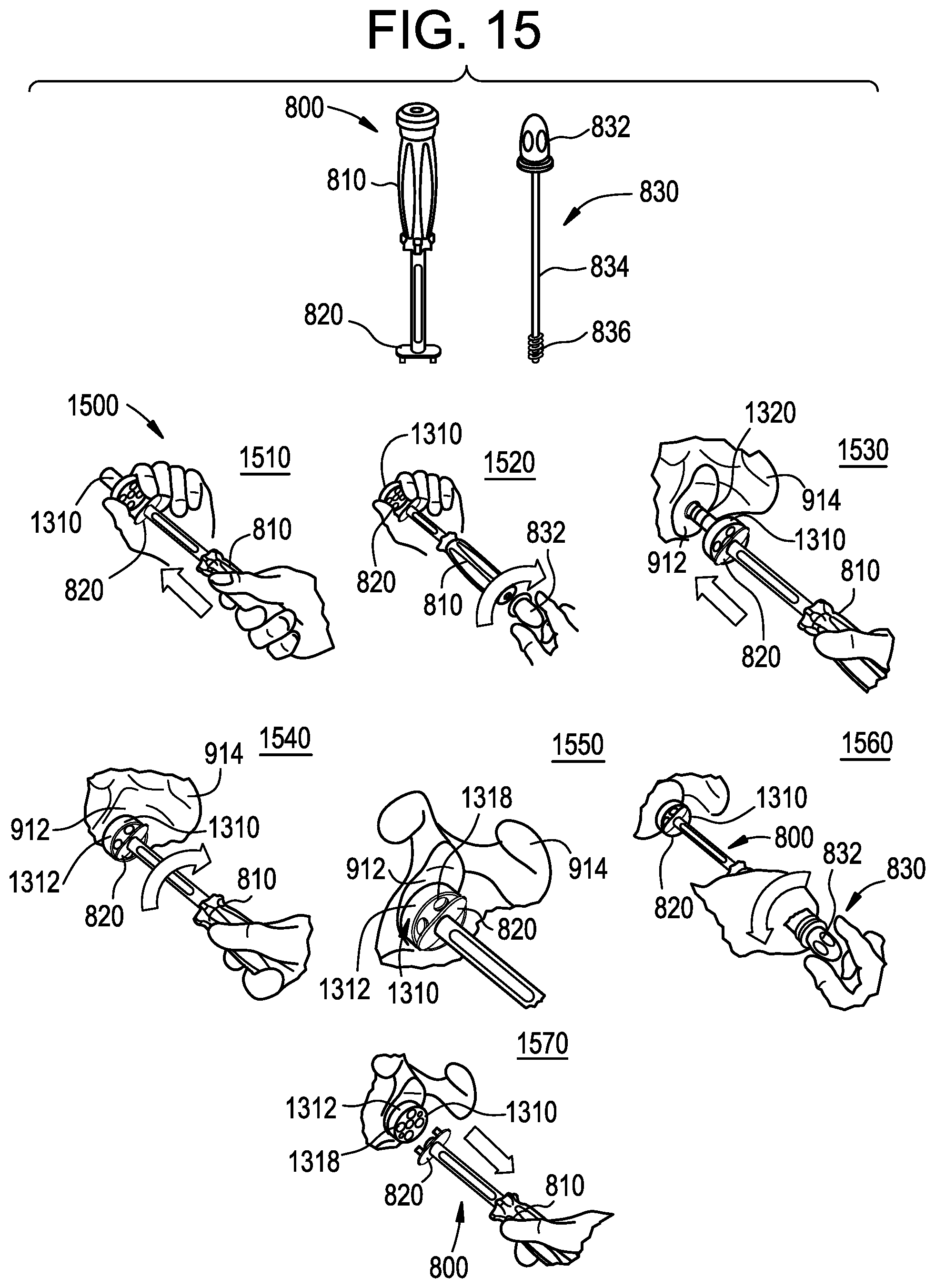 Patent US12403011 Figure 19 – Baseplate of a modular shoulder joint prosthesis and related methods for implanting the same