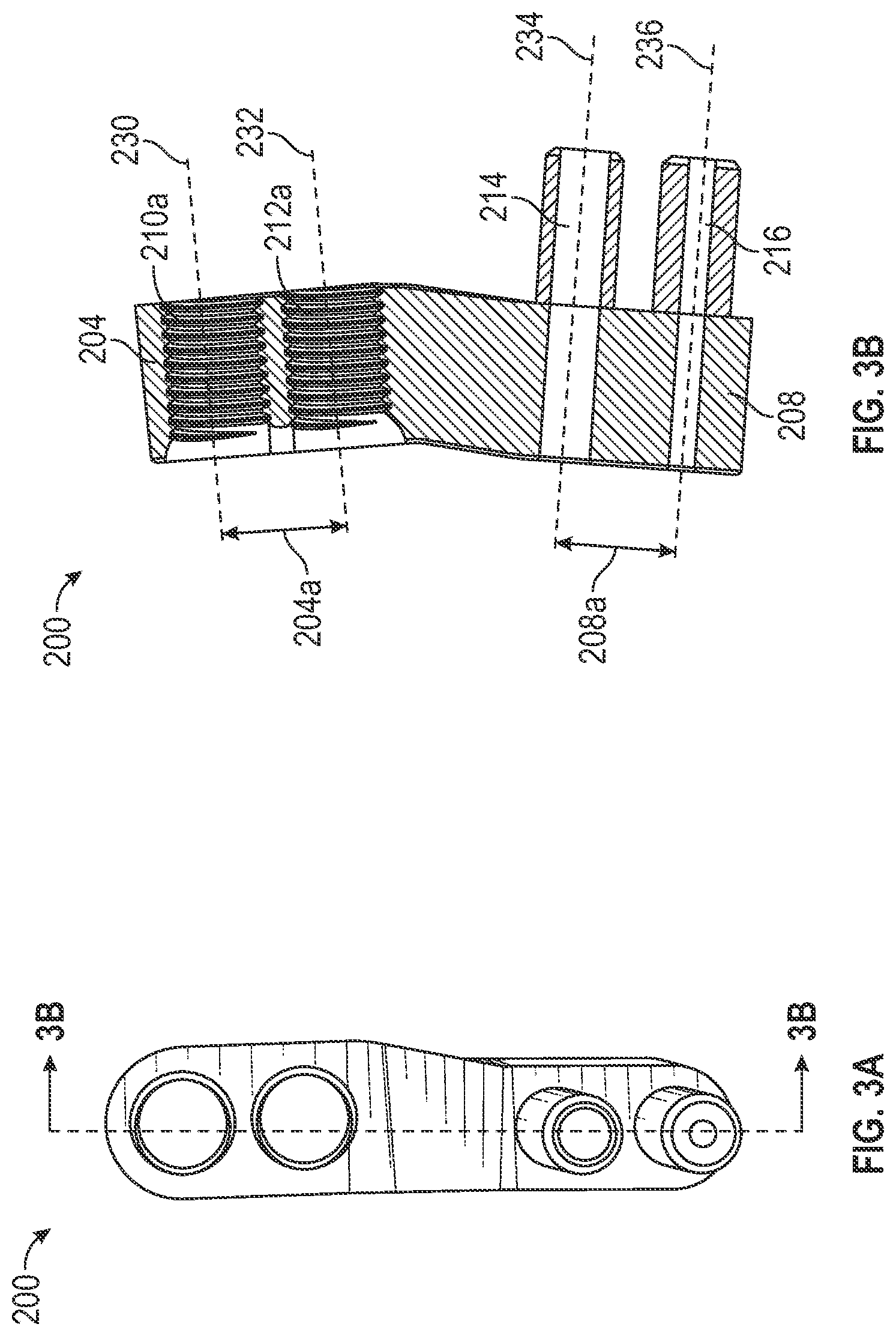 Patent US12403012 Figure 3 – Bone repositioning guide system and procedure