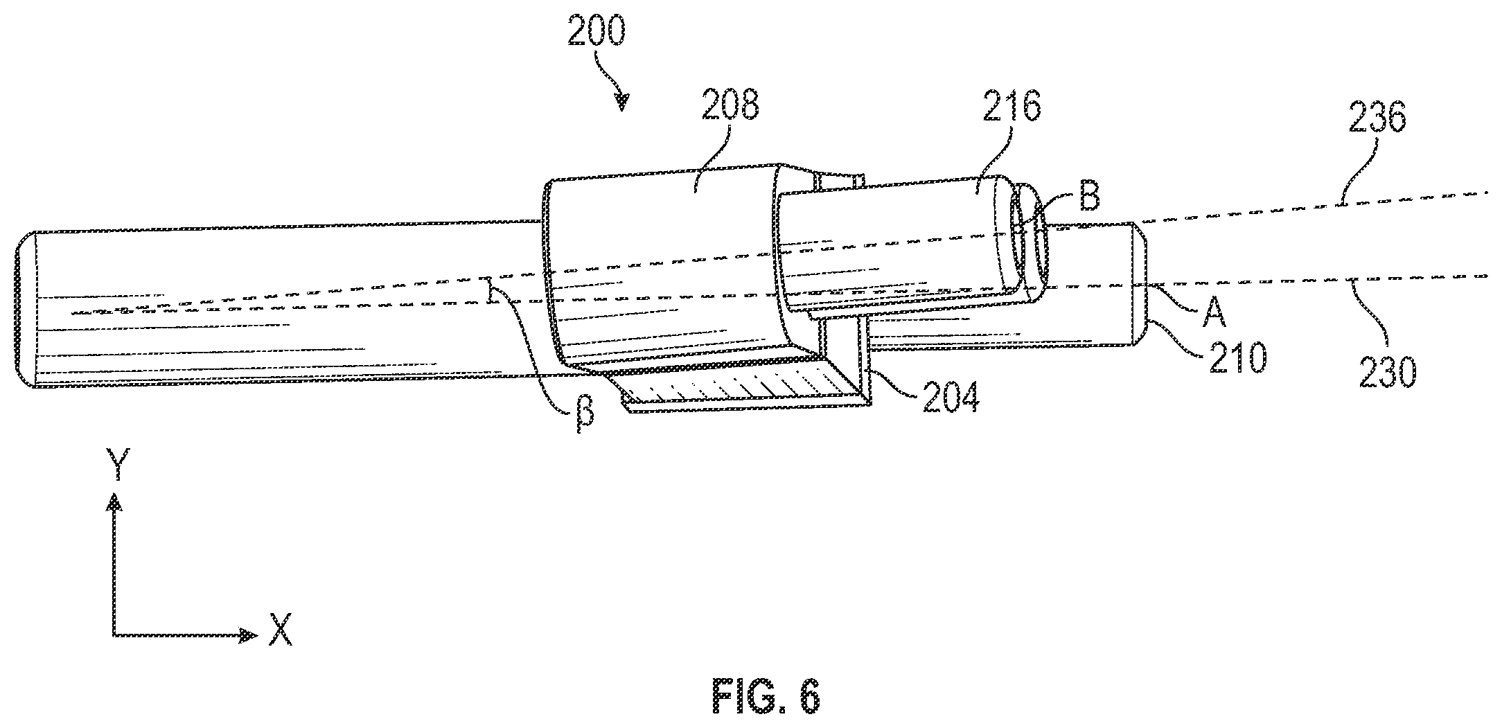 Patent US12403012 Figure 6 – Bone repositioning guide system and procedure