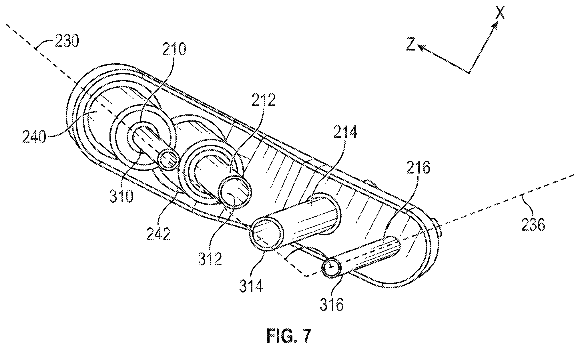 Patent US12403012 Figure 7 – Bone repositioning guide system and procedure