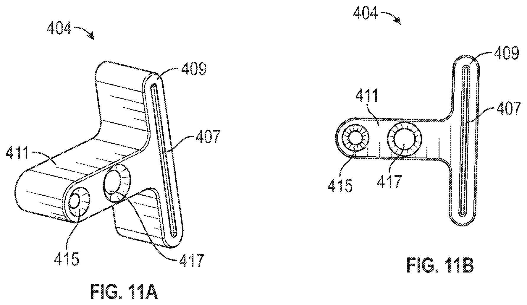 Patent US12403012 Figure 11 – Bone repositioning guide system and procedure