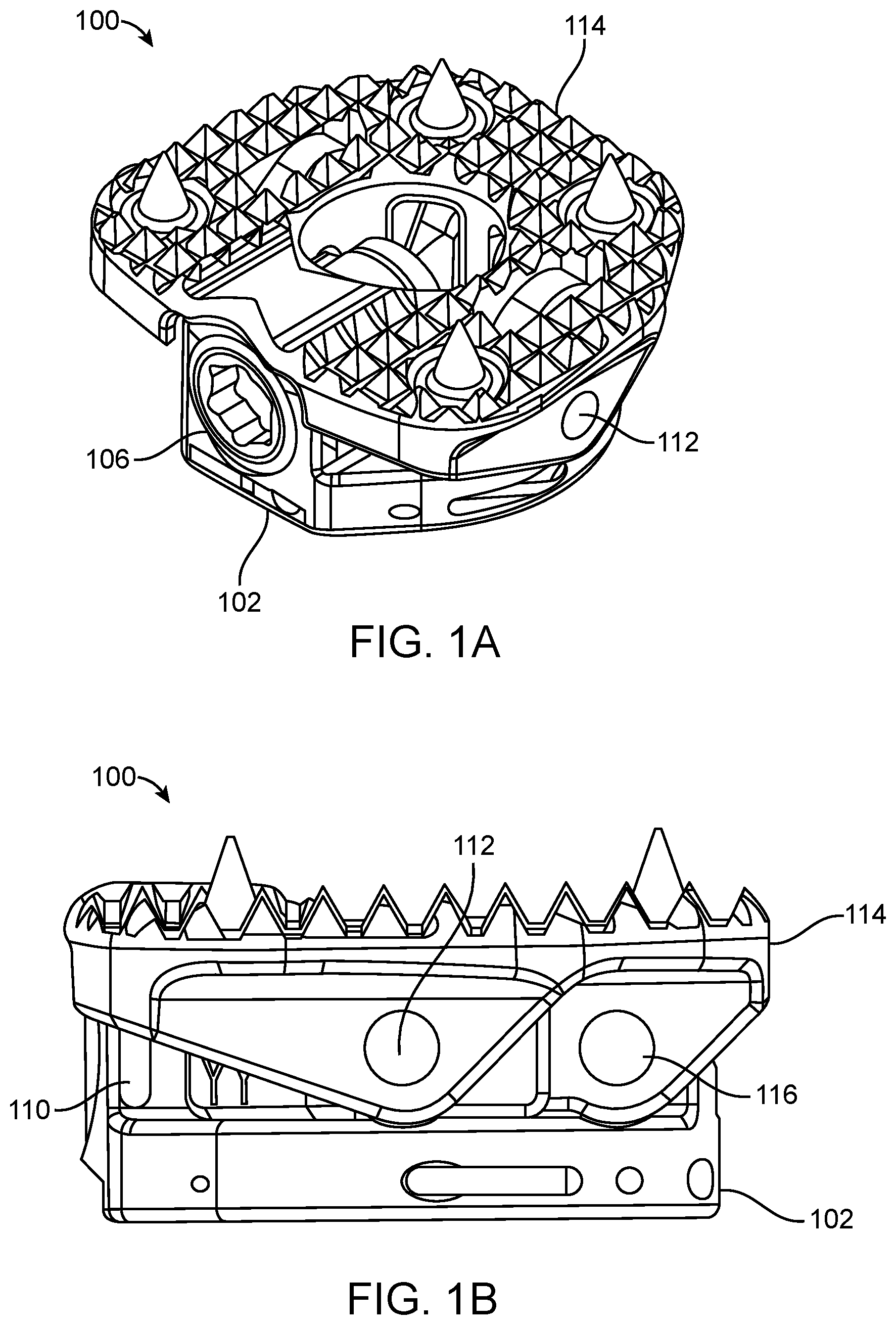 Patent US12403014 Figure 1 – Variable lordosis endplate