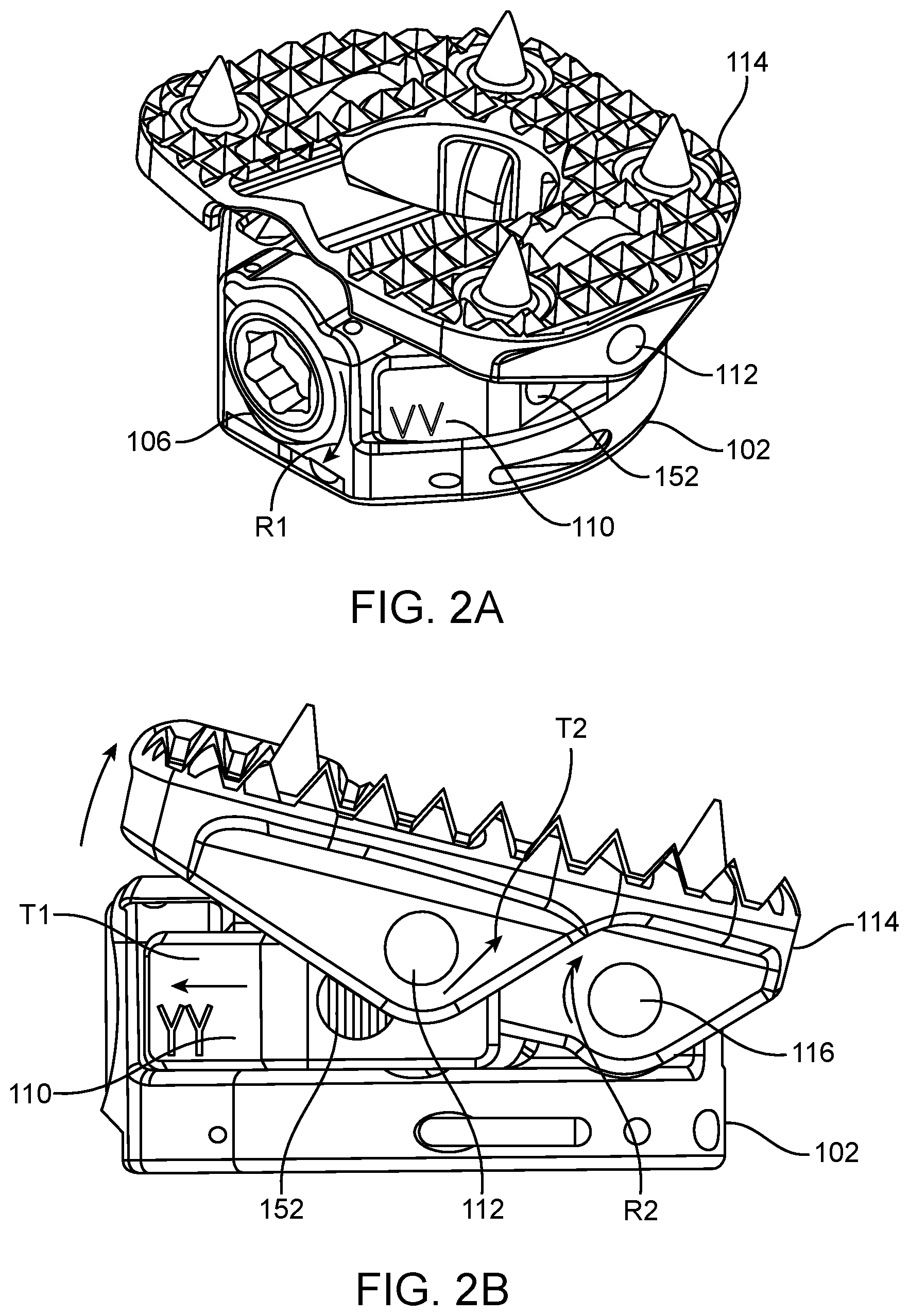 Patent US12403014 Figure 2 – Variable lordosis endplate