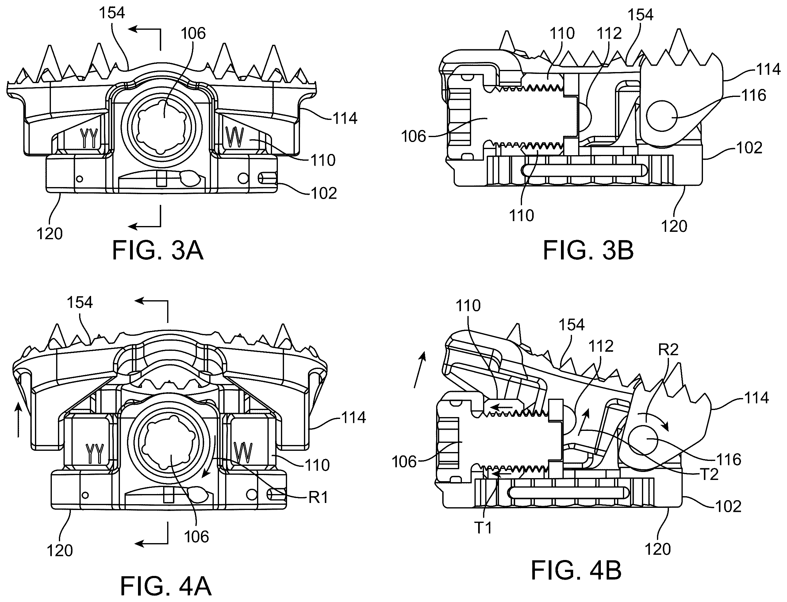 Patent US12403014 Figure 3 – Variable lordosis endplate