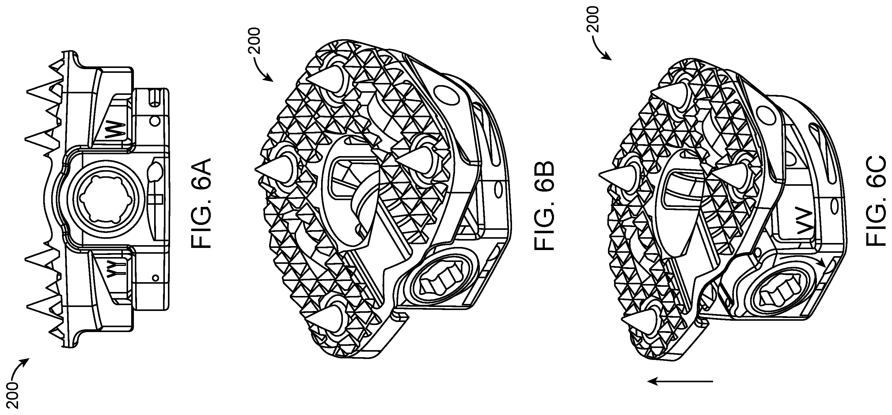 Patent US12403014 Figure 5 – Variable lordosis endplate