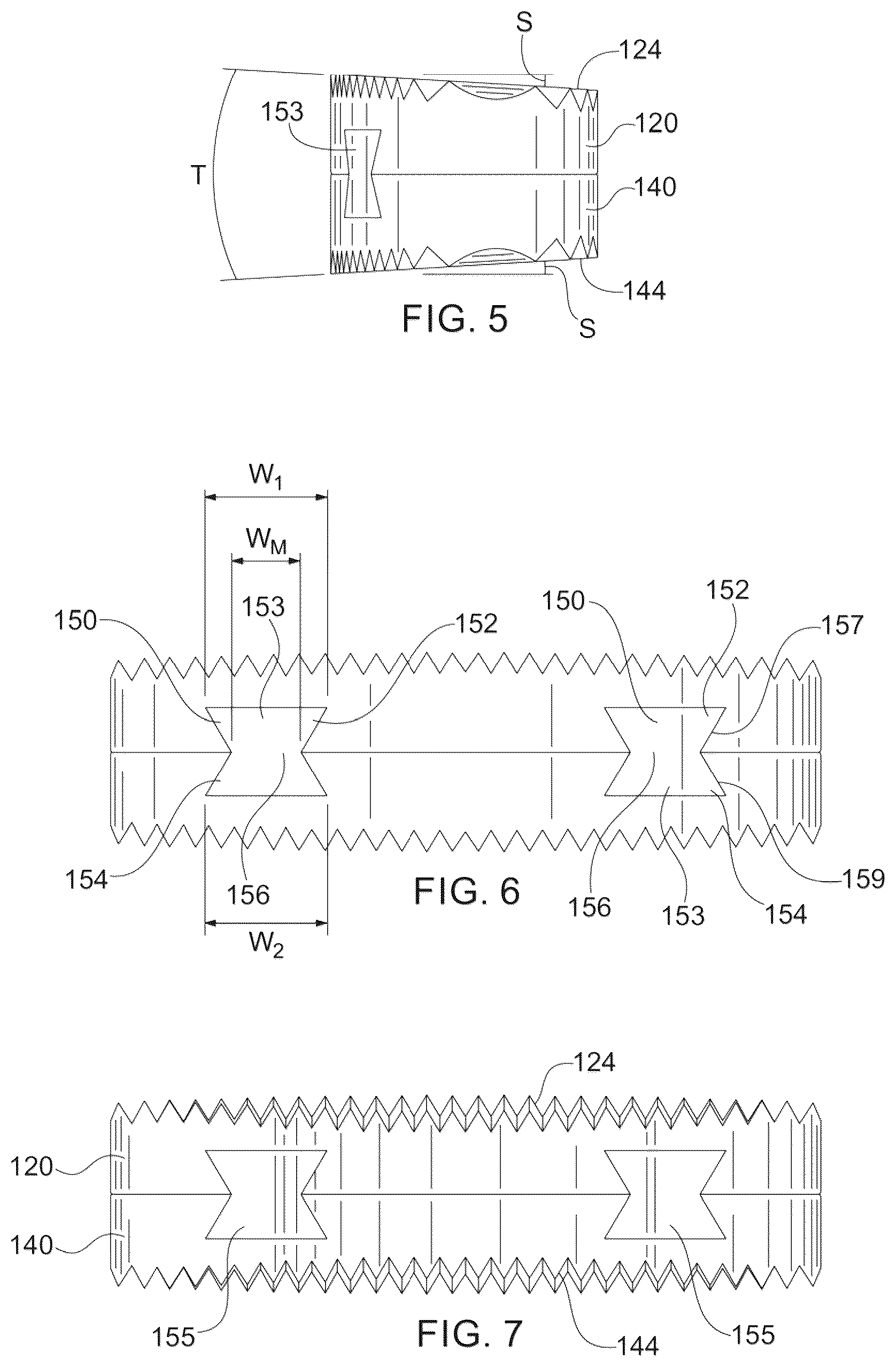 Patent US12403016 Figure 3 – Bone graft and method of making and using same