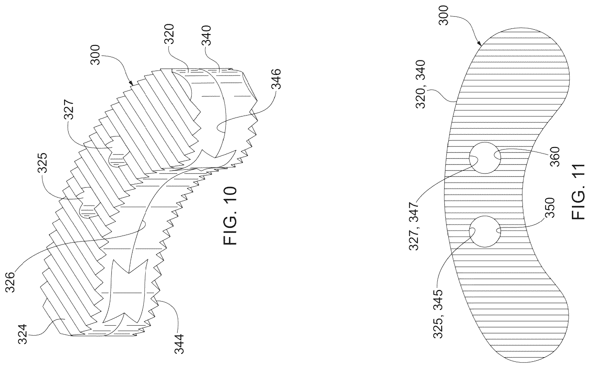 Patent US12403016 Figure 5 – Bone graft and method of making and using same