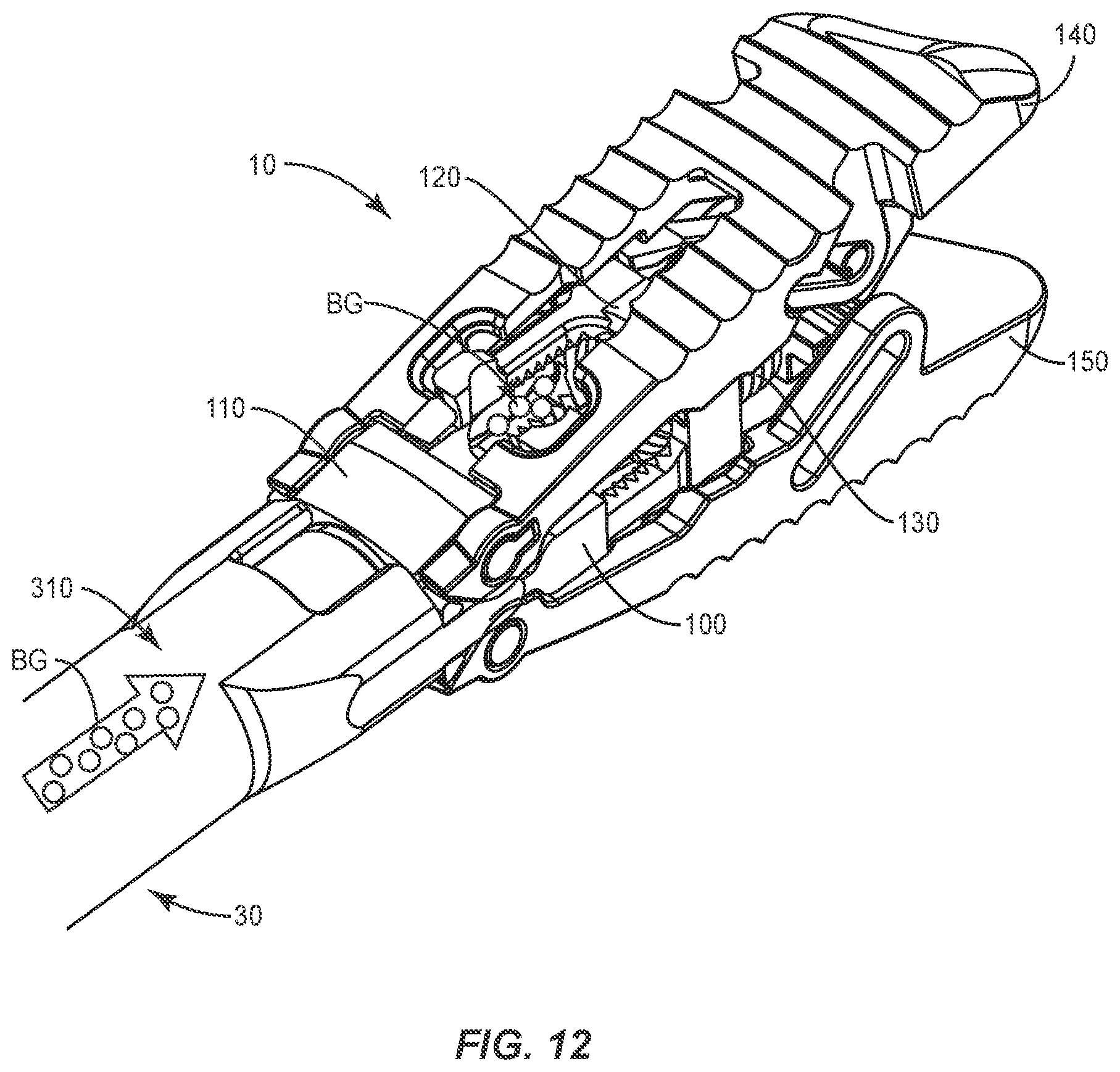Patent US12403018 Figure 13 – Expandable spinal implant system and method of using same