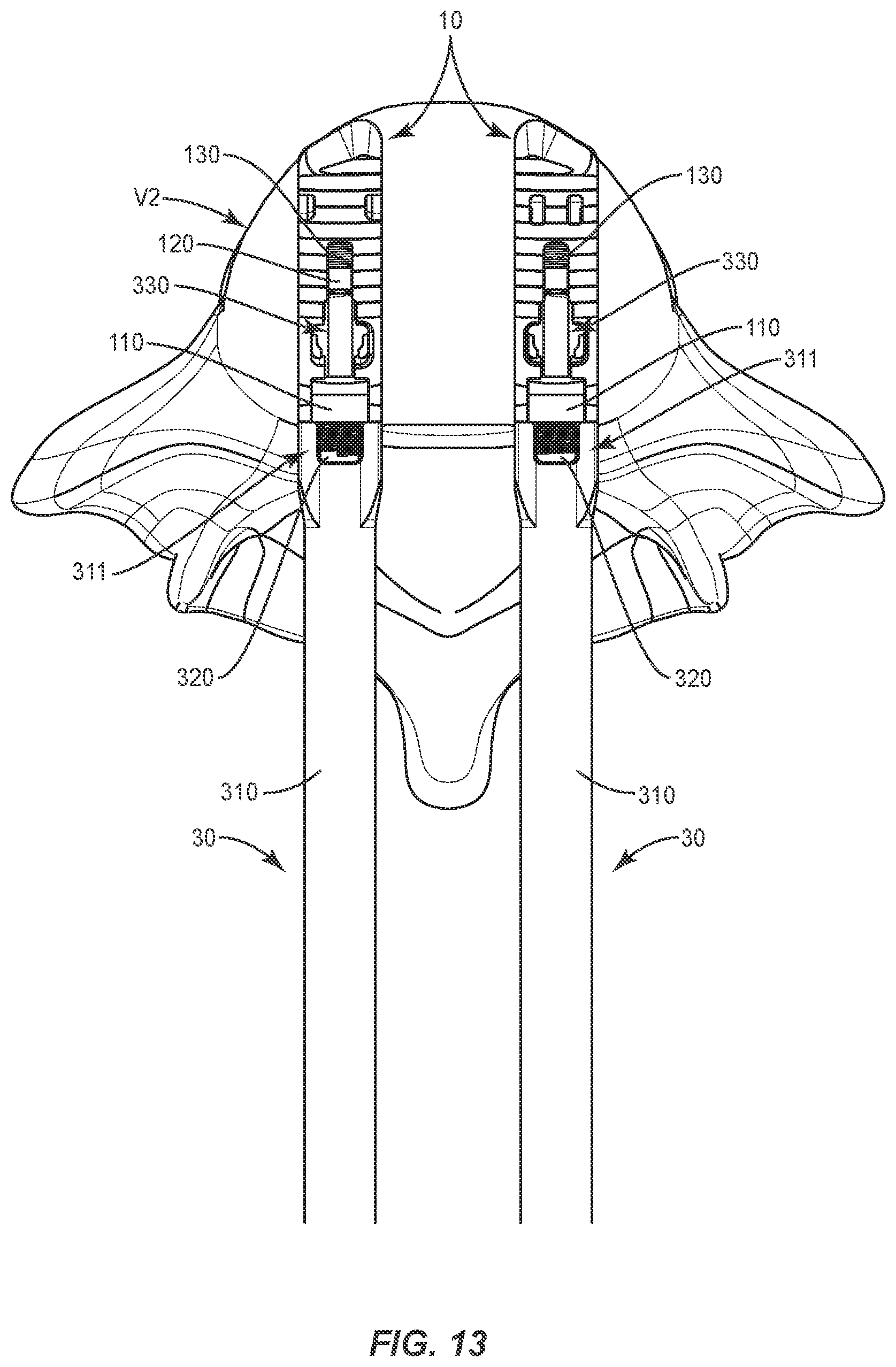 Patent US12403018 Figure 14 – Expandable spinal implant system and method of using same