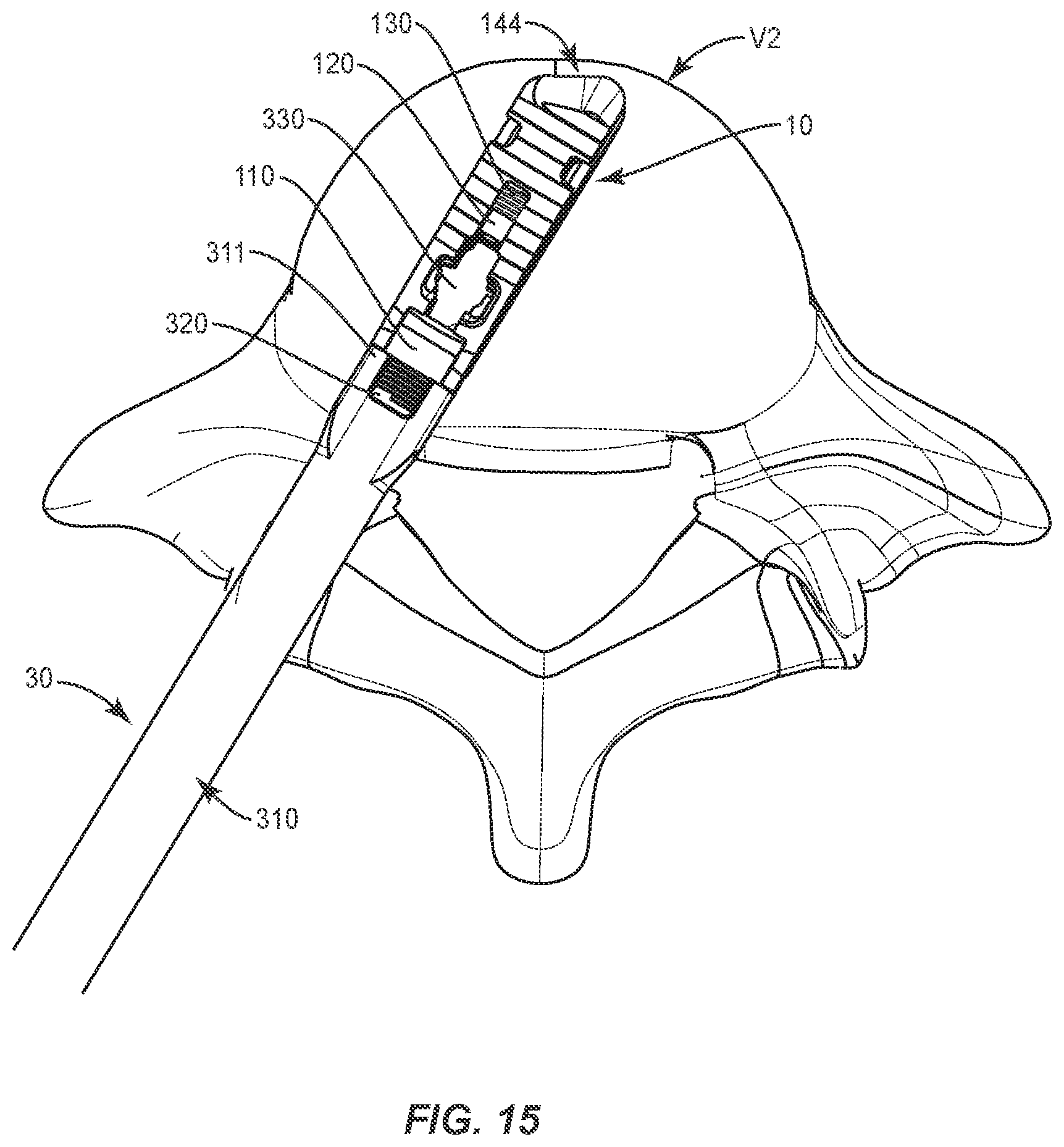 Patent US12403018 Figure 16 – Expandable spinal implant system and method of using same