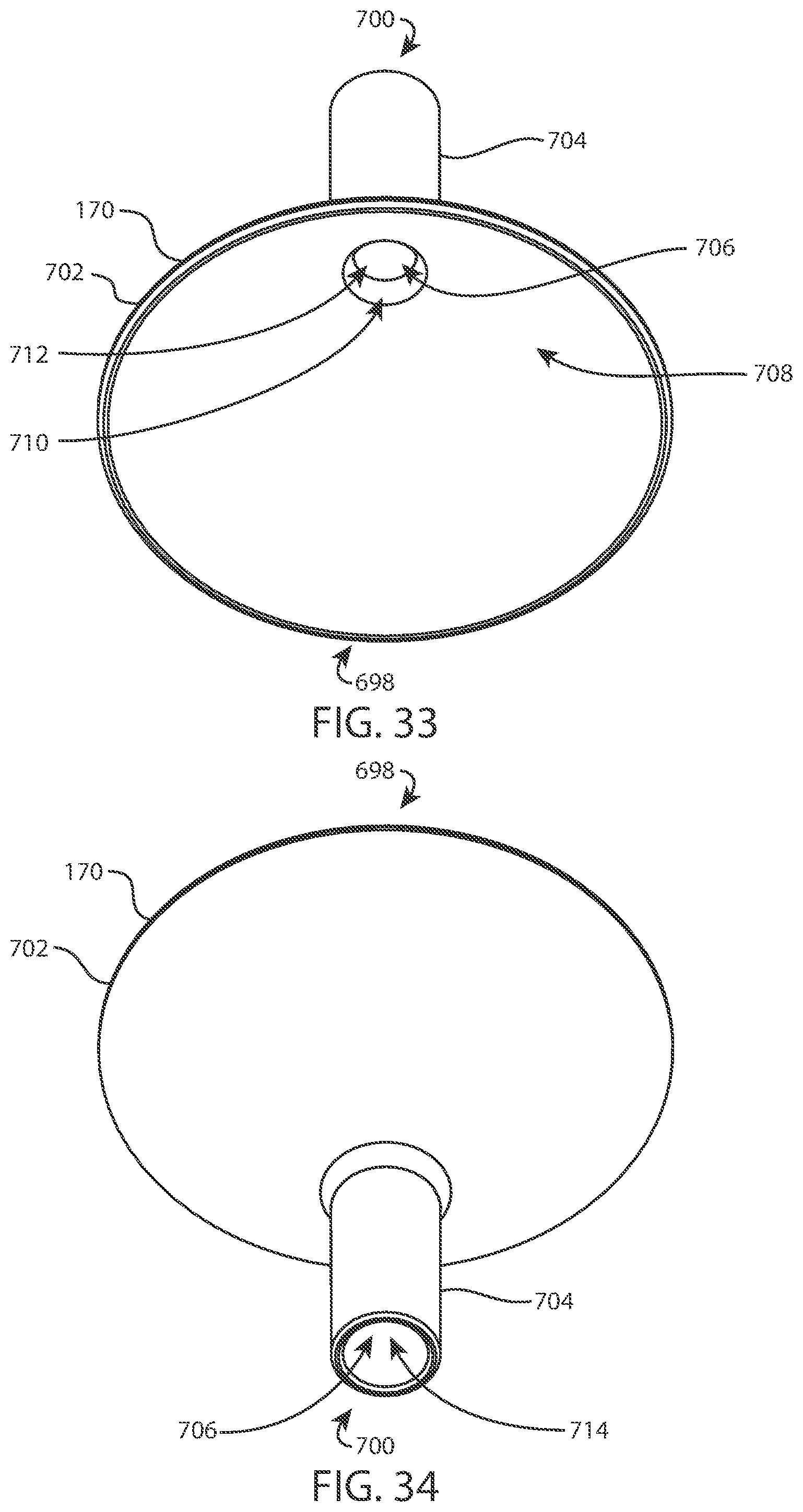 Patent US12403020 Figure 16 – Methods and instrumentation for intervertebral cage expansion