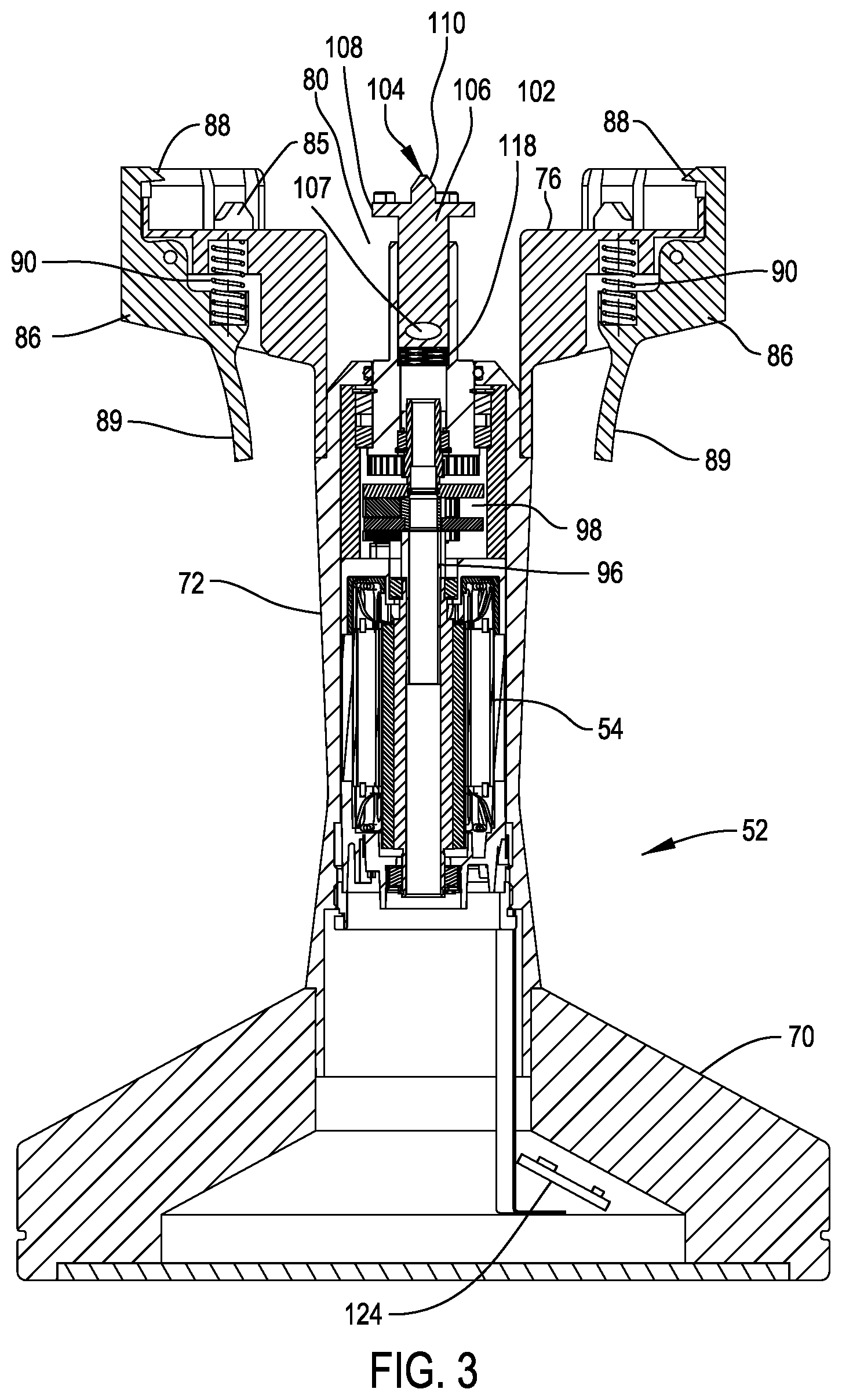 Patent US12403021 Figure 3 – System for processing bone stock including a bone cleaning head, a bone milling head and base that powers both the cleaning head and the milling head