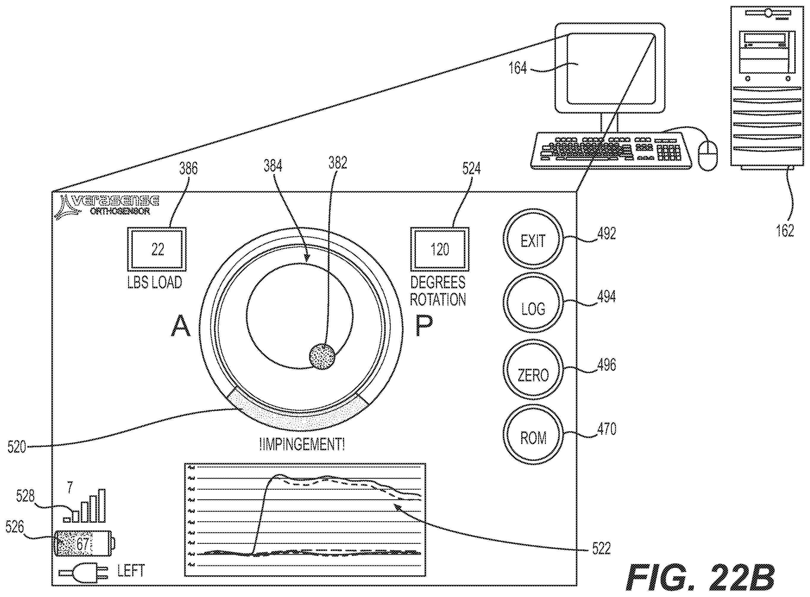 Patent US12403022 Figure 16 – Measurement system configured to support installation of a ball and socket joint and method therefor