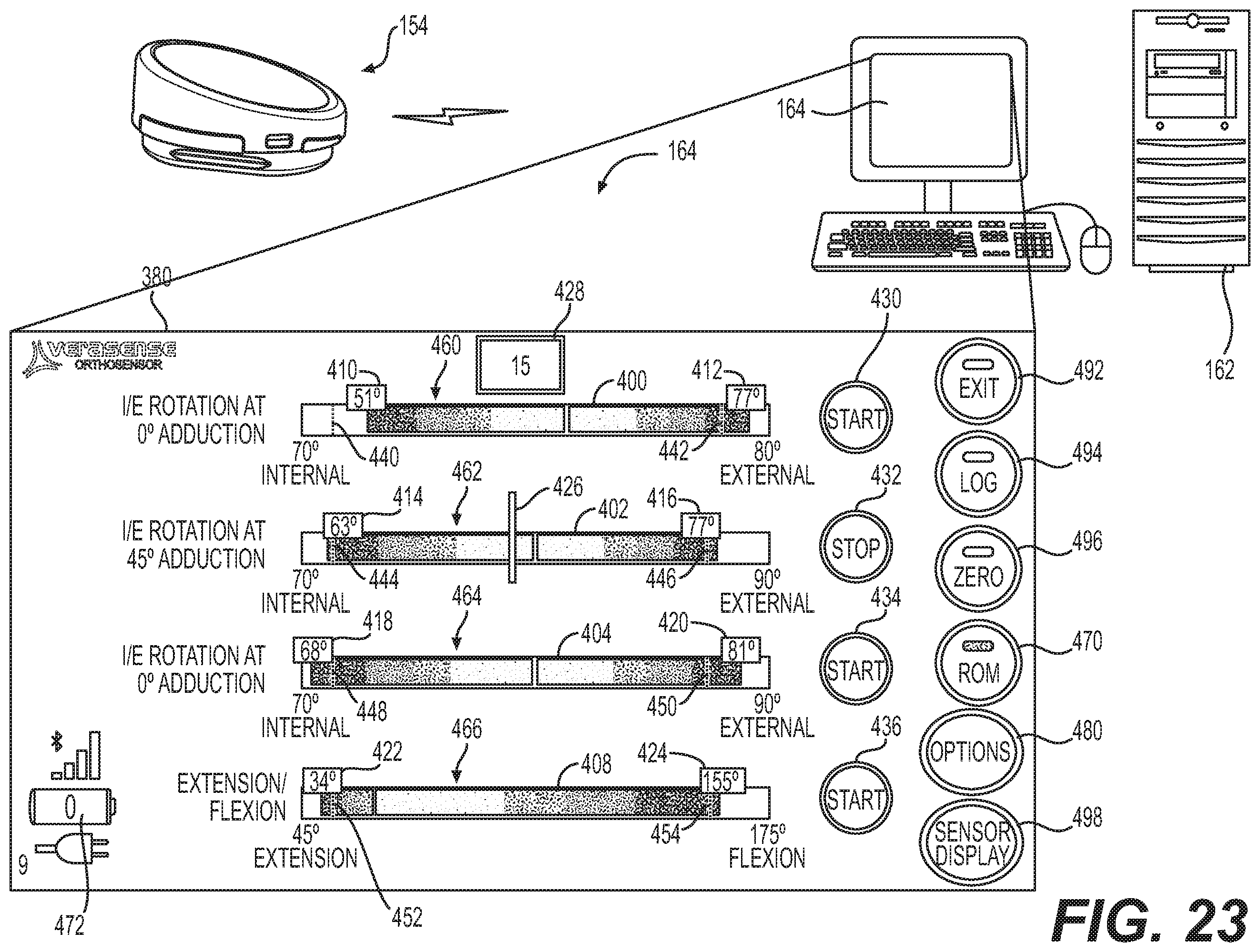 Patent US12403022 Figure 17 – Measurement system configured to support installation of a ball and socket joint and method therefor