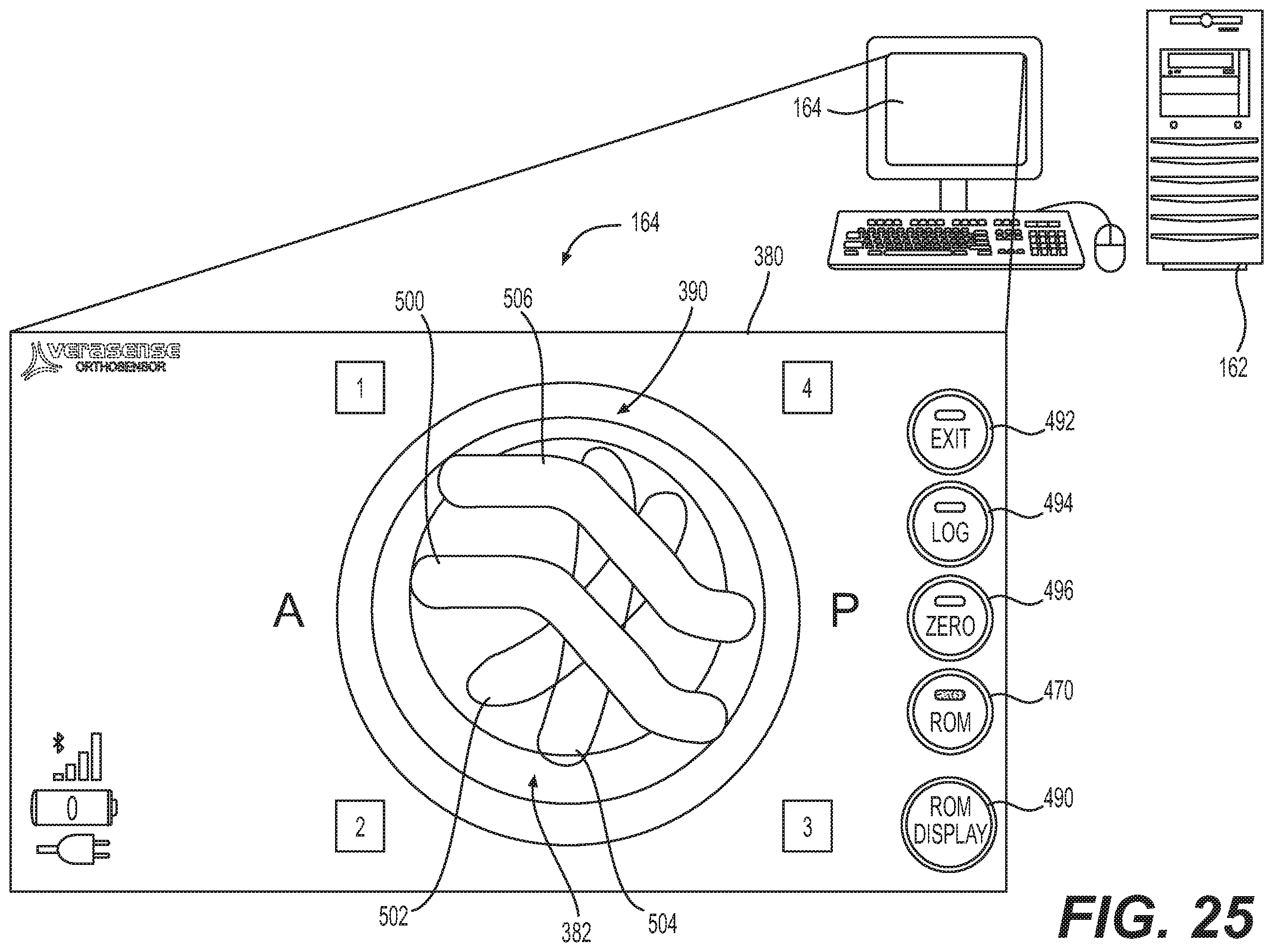Patent US12403022 Figure 19 – Measurement system configured to support installation of a ball and socket joint and method therefor