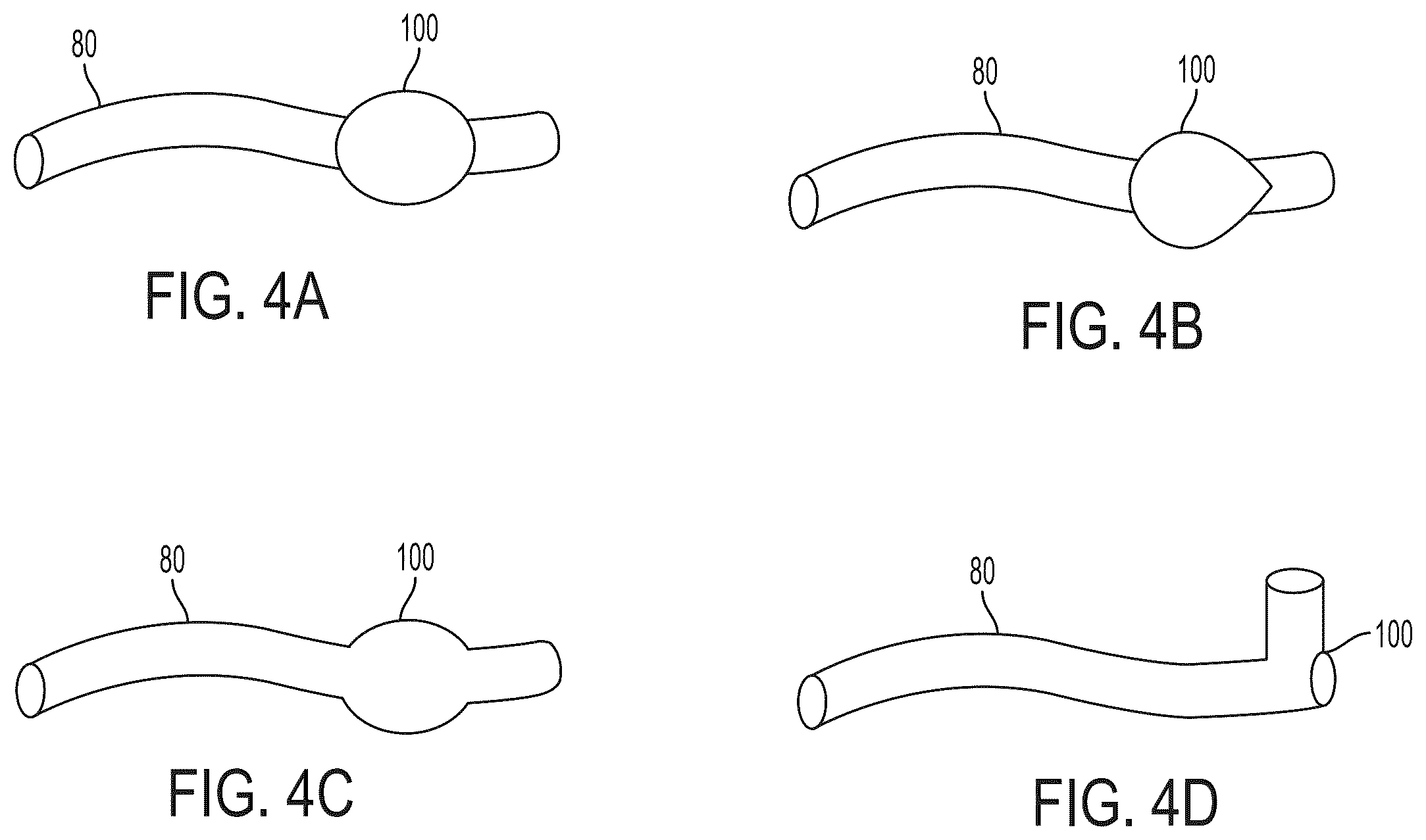 Patent US12403023 Figure 5 – Delivery system aid and associated systems and methods
