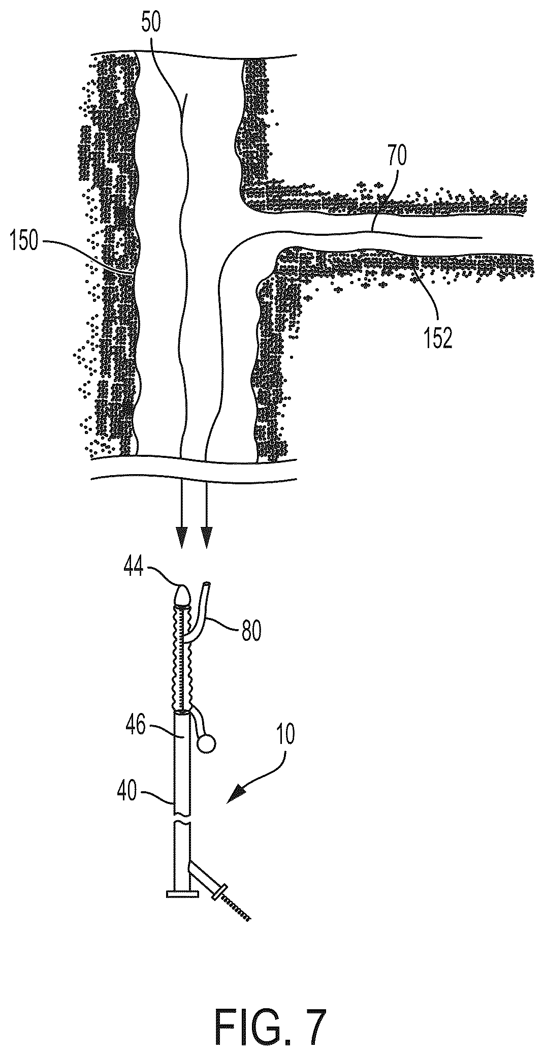Patent US12403023 Figure 8 – Delivery system aid and associated systems and methods