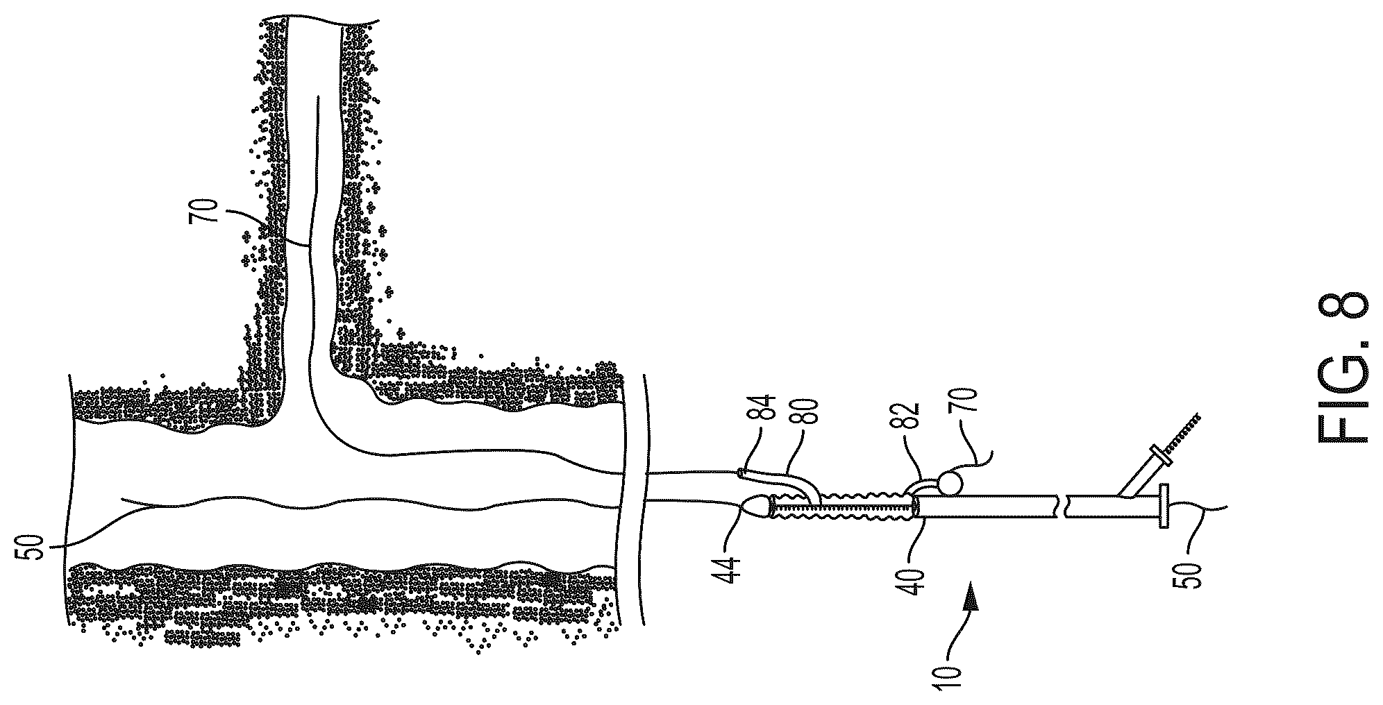 Patent US12403023 Figure 9 – Delivery system aid and associated systems and methods