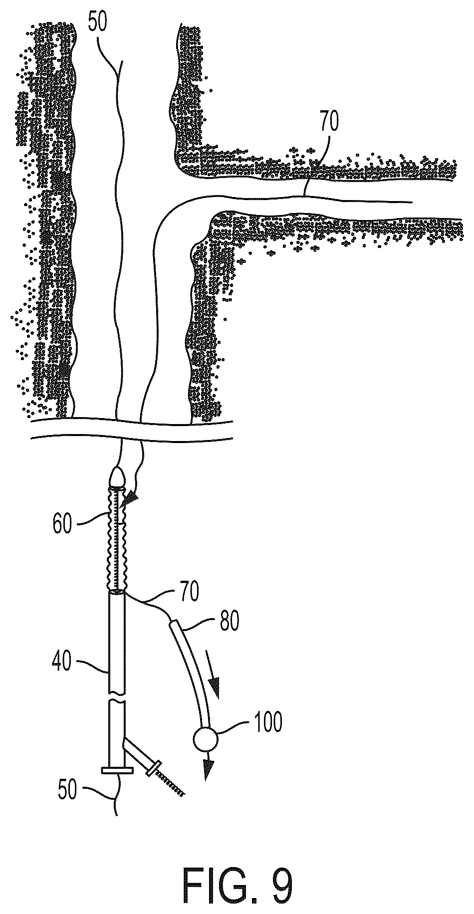 Patent US12403023 Figure 10 – Delivery system aid and associated systems and methods