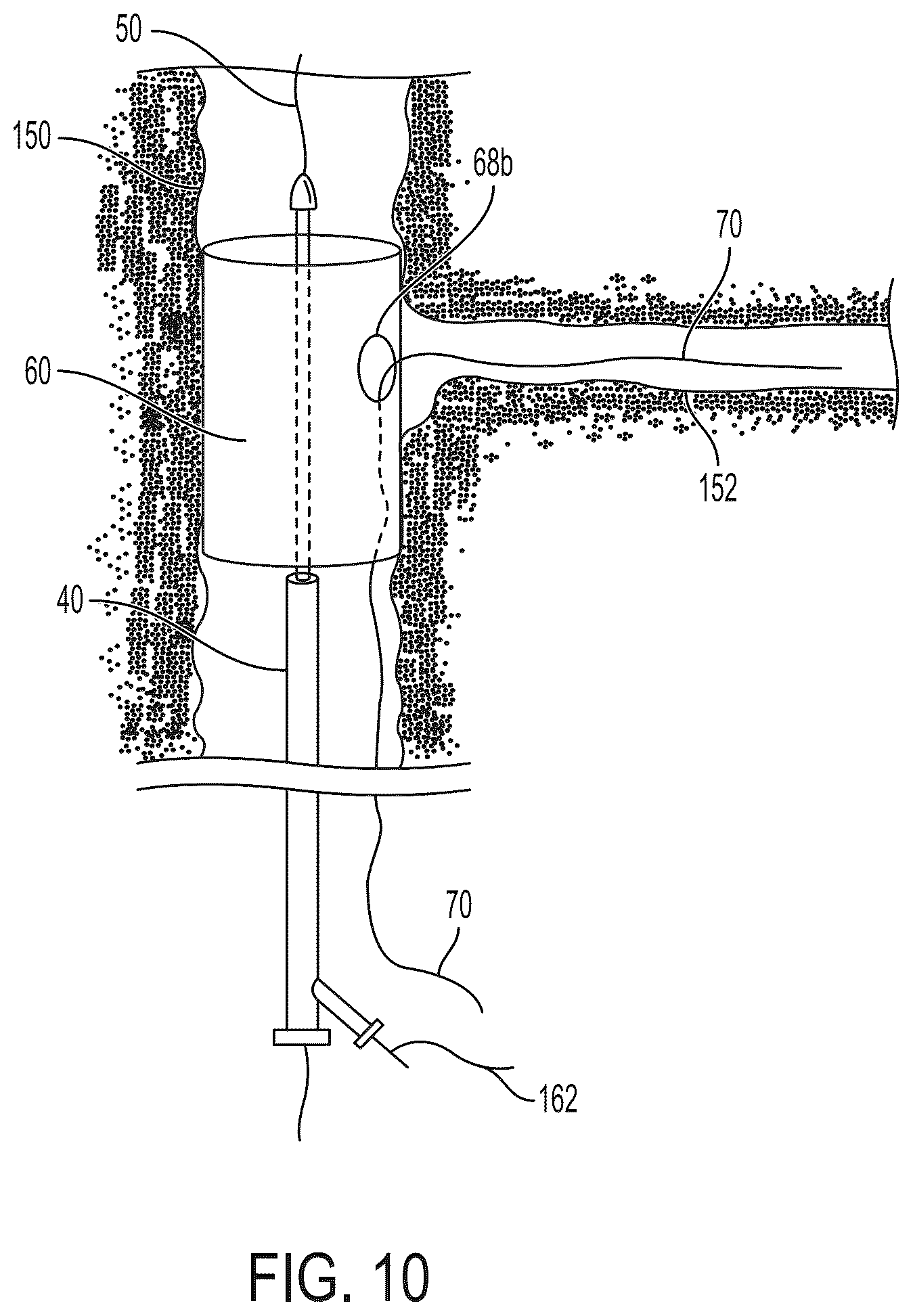 Patent US12403023 Figure 11 – Delivery system aid and associated systems and methods