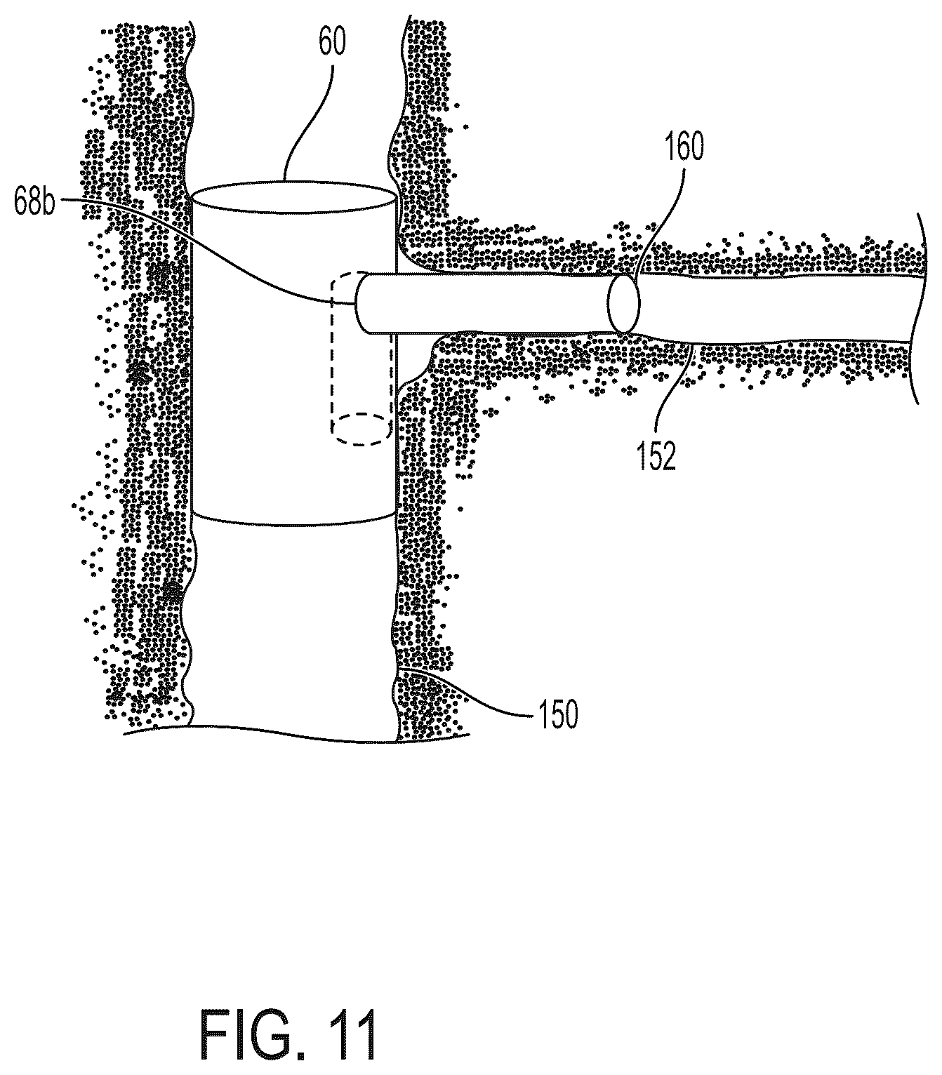 Patent US12403023 Figure 12 – Delivery system aid and associated systems and methods