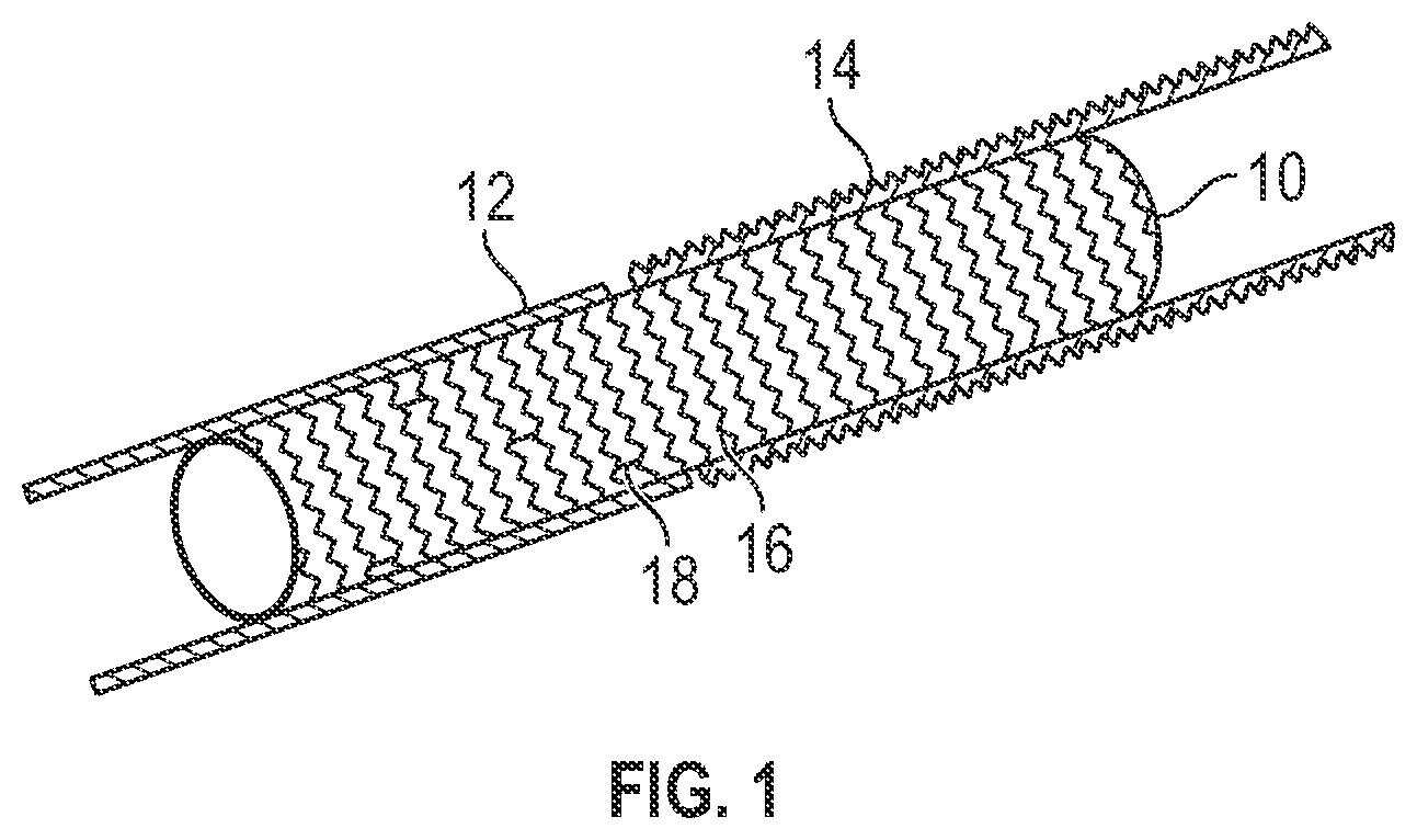 Patent US12403024 — Vascular and aortic grafts with telescoping sheath and deployment methods thereof — Figure 1