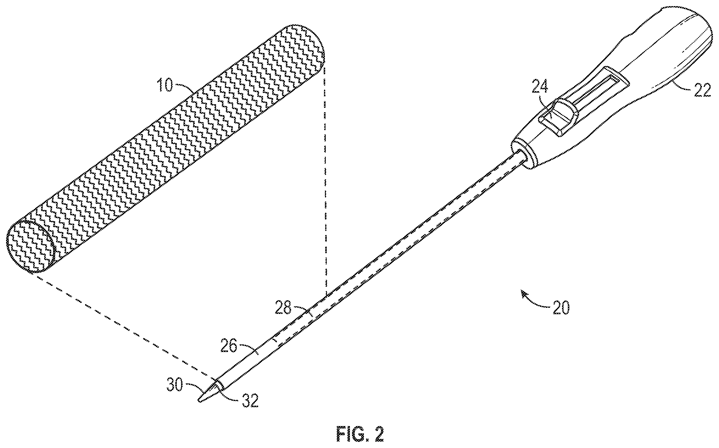 Patent US12403024 Figure 2 – Vascular and aortic grafts with telescoping sheath and deployment methods thereof
