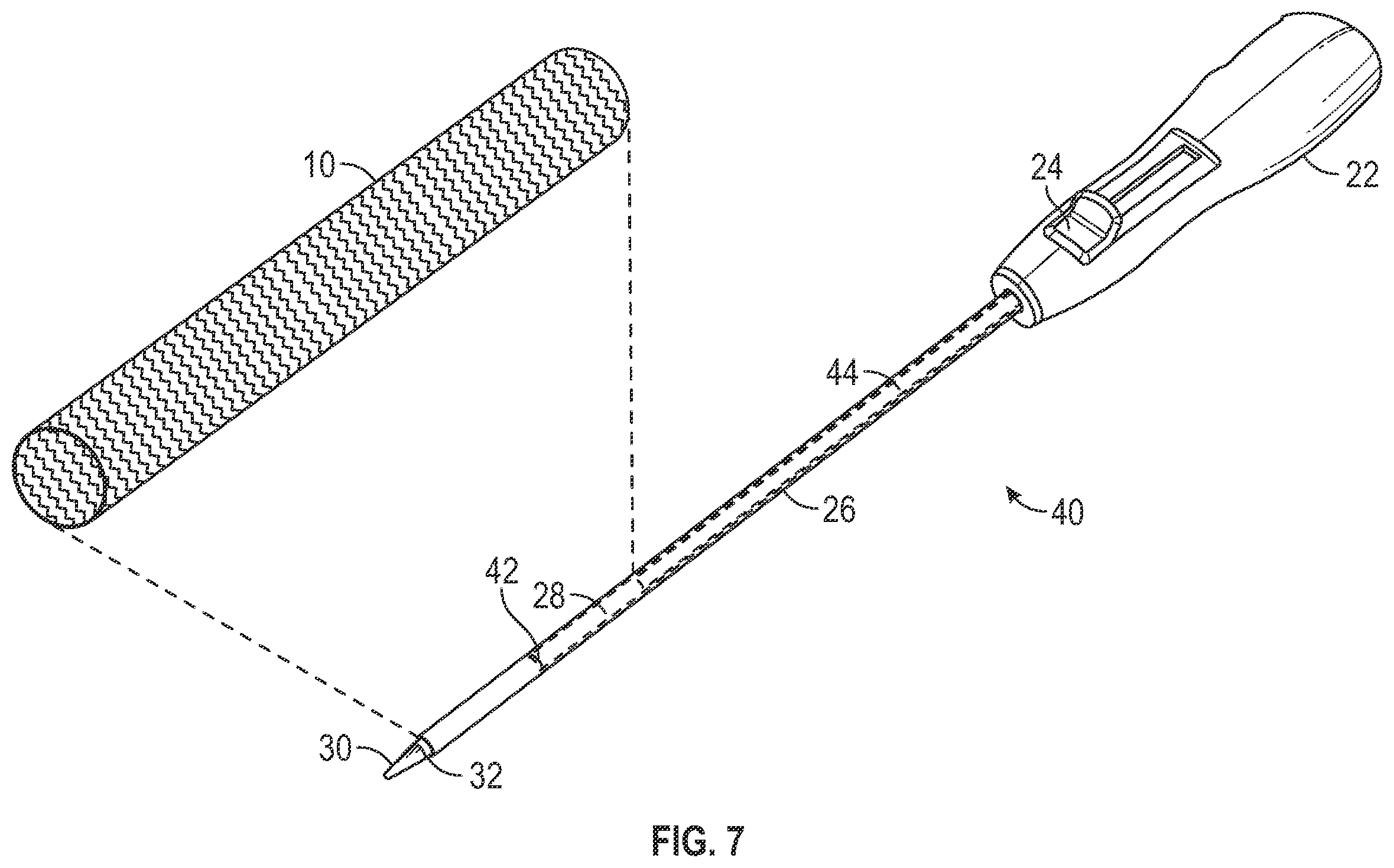 Patent US12403024 Figure 5 – Vascular and aortic grafts with telescoping sheath and deployment methods thereof
