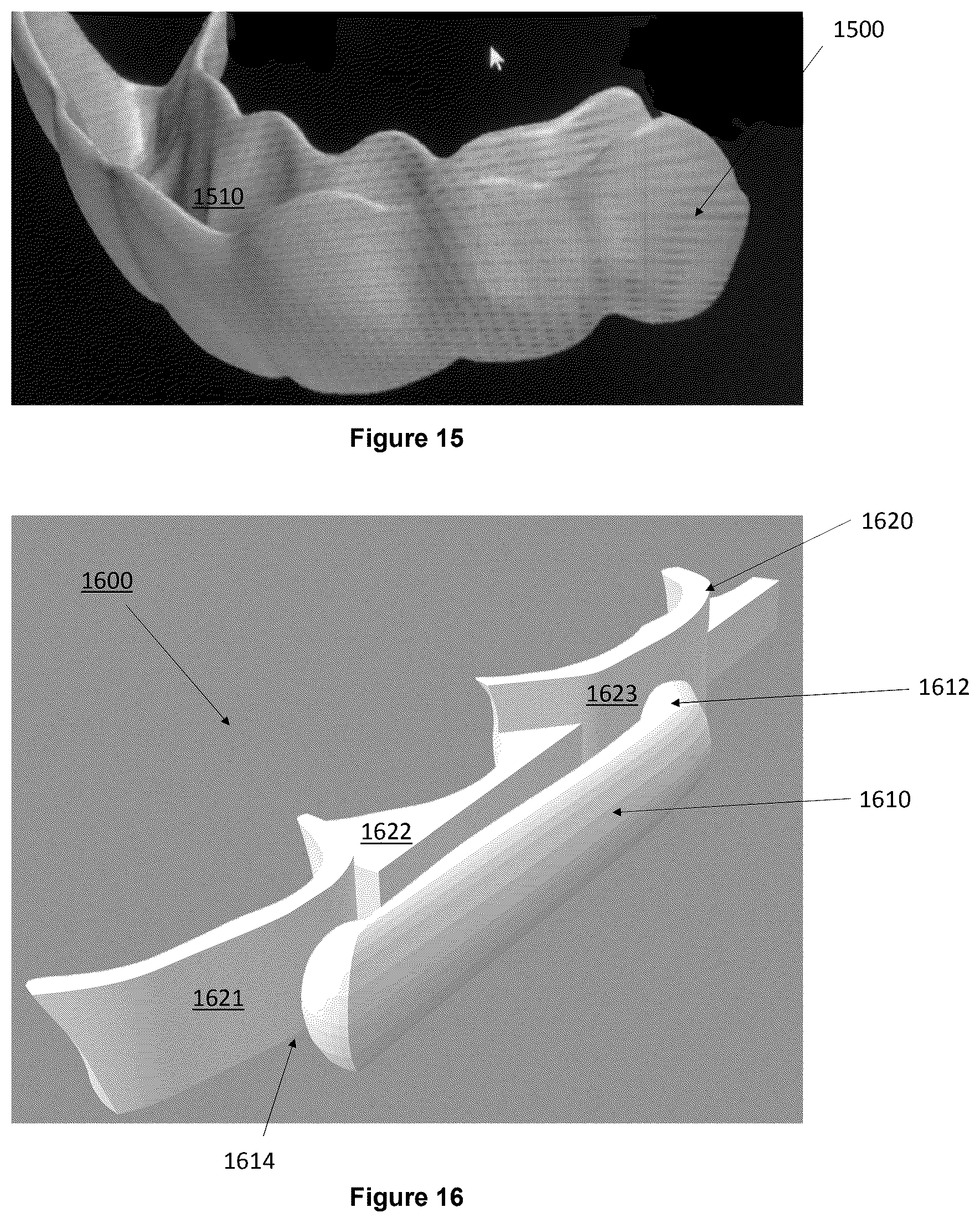 Patent US12403025 Figure 7 – Oral device to inhibit mastication and ingestion of solid food