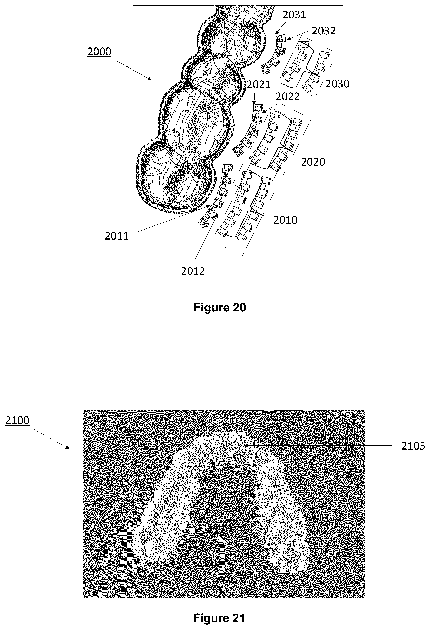 Patent US12403025 Figure 9 – Oral device to inhibit mastication and ingestion of solid food
