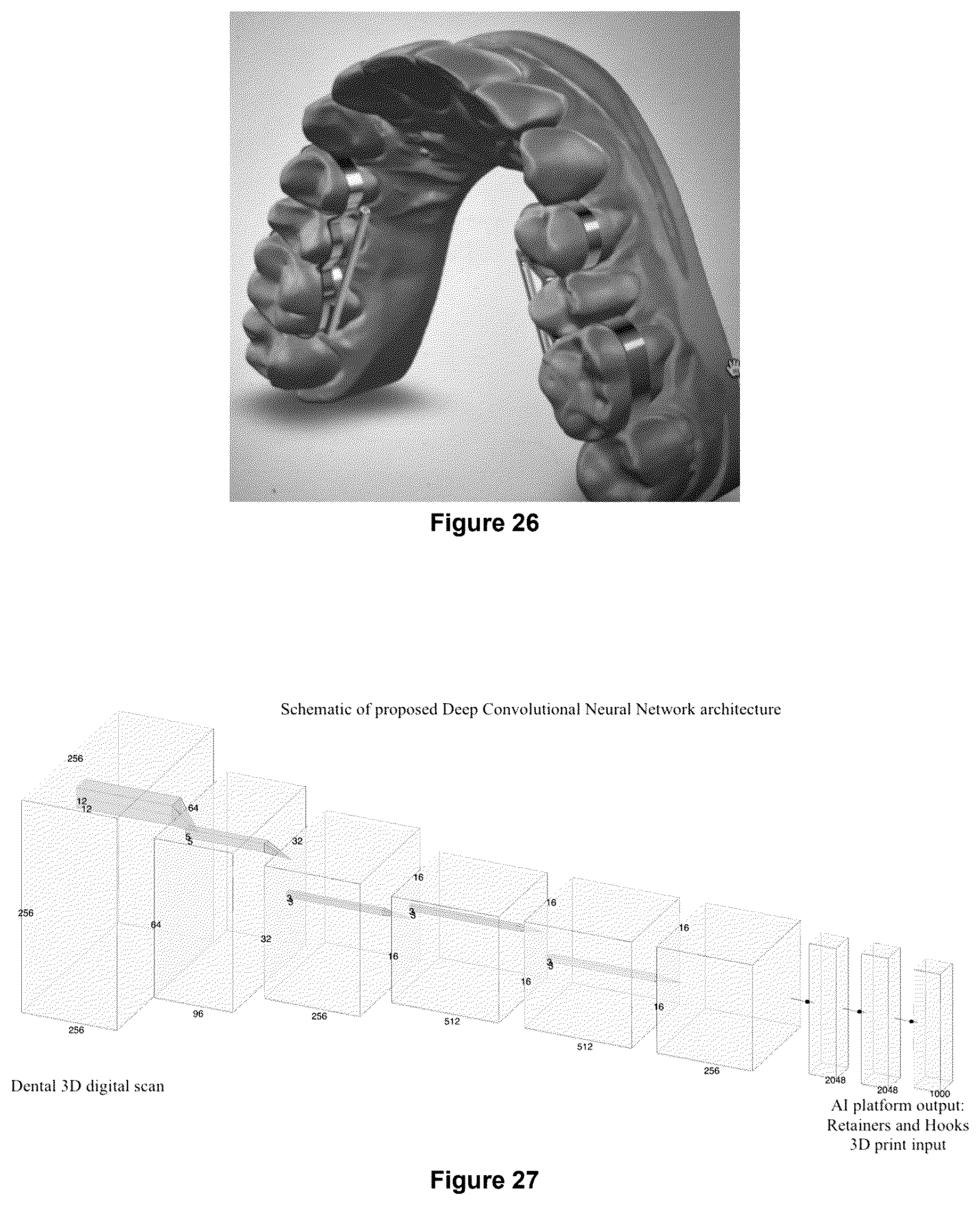Patent US12403025 Figure 12 – Oral device to inhibit mastication and ingestion of solid food