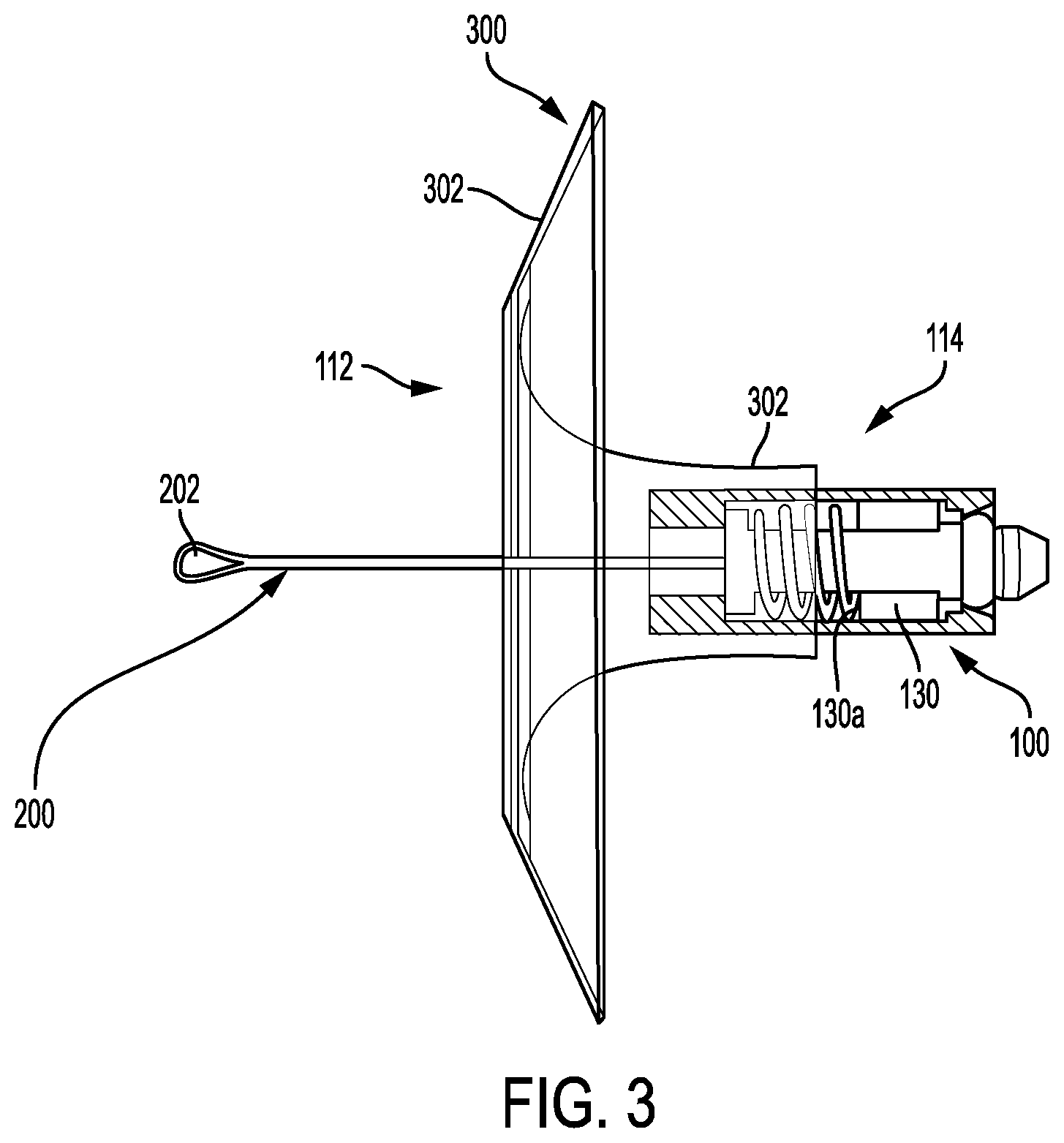 Patent US12403026 Figure 3 – Valve with docking station for gastrointestinal balloon